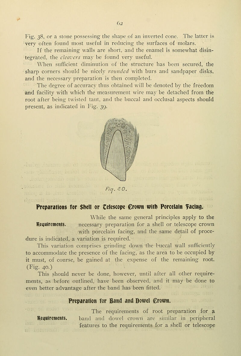 Fig. 38, or a stone possessing the shape of an inverted cone. The latter is 'very often found most useful in reducing the surfaces of molars. If the remaining walls are short, and the enamel is somewhat disin- tegrated, the cleavers may be found very useful. When sufficient diminution of the structure has been secured, the sharp corners should be nicely rounded with burs and sandpaper disks, and the necessary preparation is then completed. The degree of accuracy thus obtained will be denoted by the freedom and facility with which the measurement wire may be detached from the root after being twisted taut, and the buccal and occlusal aspects should present, as indicated in Fig. 39. Ficj. ao. Preparations for Sbell or telescope Crown witb Porcelain Tacing. While the same general principles apply to the K((tUiremcnt$. necessary preparation for a shell or telescope crown with porcelain facing, and the same detail of proce- dure is indicated, a variation is required. This variation comprises grinding down the buccal wall sufficiently to accommodate the presence of the facing, as the area to be occupied by it must, of course, be gained at the expense of the remaining root. (Fig. 40.) This should never be done, however, until after all other require- ments, as before outlined, have been observed, and it may be done to even better advantage after the band has been fitted. Preparation for Band ana Dowel £rown. The requirements of root preparation for 9. K^dUiretiKlttS. band and dowel crown are similar in peripheral features to the requirements for a shell or telescope