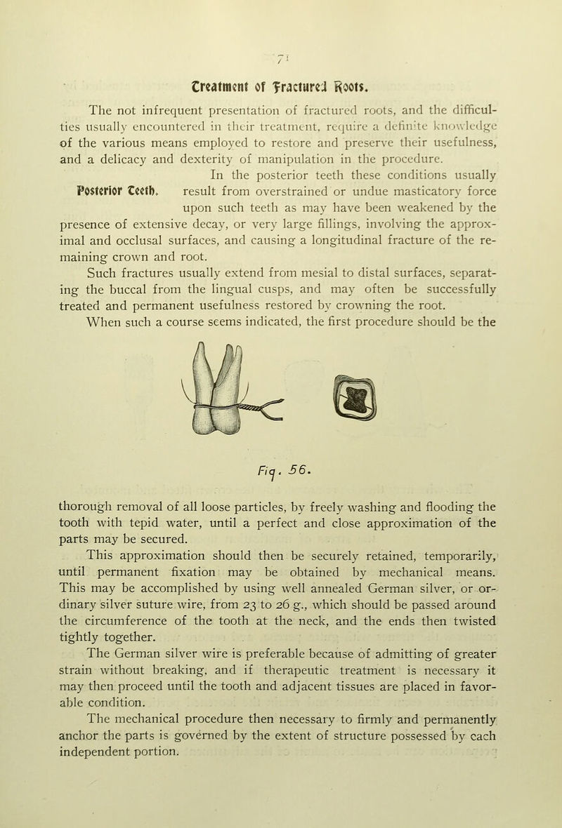 Crcatmcnt of TractureJ Roots. The not infrequent presentation of fractured roots, and the difficul- ties usually encountered in their treatment, require a definite knowledge of the various means employed to restore and preserve their usefulness, and a delicacy and dexterity of manipulation in the procedure. In the posterior teeth these conditions usually Posterior Ccctb> result from overstrained or undue masticatory force upon such teeth as may have been weakened by the presence of extensive decay, or very large fillings, involving the approx- imal and occlusal surfaces, and causing a longitudinal fracture of the re- maining crown and root. Such fractures usually extend from mesial to distal surfaces, separat- ing the buccal from the lingual cusps, and may often be successfully treated and permanent usefulness restored by crowning the root. When such a course seems indicated, the first procedure should be the Ficj. 56. thorough removal of all loose particles, by freely washing and flooding the tooth with tepid water, until a perfect and close approximation of the parts may be secured. This approximation should then be securely retained, temporarily, until permanent fixation may be obtained by mechanical means. This may be accomplished by using well annealed German silver, or or^ dinary silver suture wire, from 23 to 26 g., which should be passed around the circumference of the tooth at the neck, and the ends then twisted tightly together. The German silver wire is preferable because of admitting of greater strain without breaking, and if therapeutic treatment is necessary it may then proceed until the tooth and adjacent tissues are placed in favor- able condition. The mechanical procedure then necessary to firmly and permanently anchor the parts is governed by the extent of structure possessed by each independent portion. •