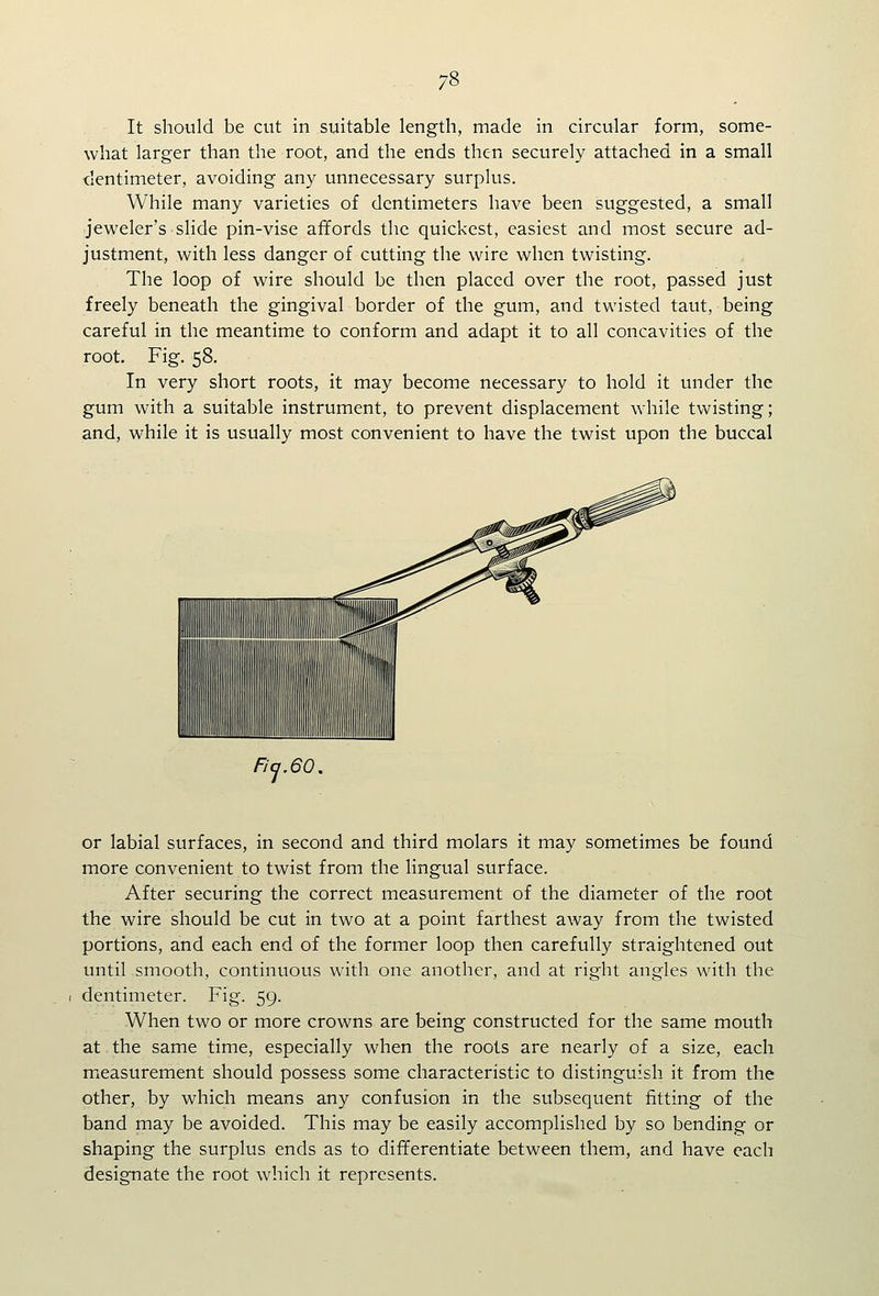 It should be cut in suitable length, made in circular form, some- what larger than the root, and the ends then securely attached in a small Centimeter, avoiding any unnecessary surplus. While many varieties of dentimeters have been suggested, a small jeweler's slide pin-vise affords the quickest, easiest and most secure ad- justment, with less danger of cutting the wire when twisting. The loop of wire should be then placed over the root, passed just freely beneath the gingival border of the gum, and twisted taut, being careful in the meantime to conform and adapt it to all concavities of the root. Fig. 58. In very short roots, it may become necessary to hold it under the gum with a suitable instrument, to prevent displacement while twisting; and, while it is usually most convenient to have the twist upon the buccal Fiq,60, or labial surfaces, in second and third molars it may sometimes be found more convenient to twist from the lingual surface. After securing the correct measurement of the diameter of the root the wire should be cut in two at a point farthest away from the twisted portions, and each end of the former loop then carefully straightened out until smooth, continuous with one another, and at right angles with the dentimeter. Fig. 59. When two or more crowns are being constructed for the same mouth at the same time, especially when the roots are nearly of a size, each measurement should possess some characteristic to distinguish it from the other, by which means any confusion in the subsequent fitting of the band may be avoided. This may be easily accomplished by so bending or shaping the surplus ends as to differentiate between them, and have each designate the root which it represents.