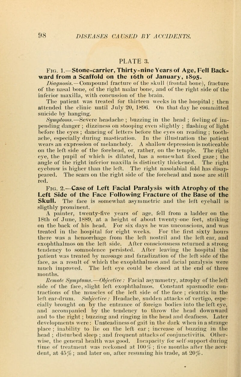 PLATE 3. Fm. l.—Stone=carrier,Thirty=nine Years of Age, Fell Back- ward from a Scaffold on the i6th of January, 1895. /.'/V/^'Ho.s/s. —Com pound fracture ol'tho skull (t'roiitiil bone), fraoture of the nasal bone, of the right malar bone, and of the right side of the inferior maxilla, with concussion of the brain. The j)atieut was treated for thirteen weeks in the hospital ; tlien attended the clinic until July 20, 1896. On that day he committed suicide by hanging. Symptoms.—Severe headache ; l)uzzing in the head; feeling of im- pending danger ; dizziness on stooping even slightly ; flashing of light before the eyes ; dancing of letteis before the eyes on reading ; tooth- ache, especially during mastication. In the illustration the patient w^ears an expression of melancholy. A shallow depression is noticeable on the leftside of the tbreliead, or, rather, on the temple. The right eye, the i)upil of which is dilated, has a somewhat fixed gaze; the angle of the right inferior maxilla is distinctly thickened. The light eyebrow is higher than the left. The right na.solabial ibid has disap- peared. The scars on the right side of the forehead and nose are still red. Fig. 2.—Case of Left Facial Paralysis with Atrophy of the Left Side of the Face Following Fracture of the Base of the Skull. The face is somewhat asymmetric and the leit eyeball is sligthly prominent. A painter, twenty-live years of age, fell from a ladder on the 18th of June, 1889, at a height of a1)out twenty-one feet, striking on the back of his head. For six days he was unconscious, and was treated in the hospital lor eight weeks. For the first sixty liours there was a hemorrhage from the left nostril and the left ear, and exojjhthalmos on the left side. After consciousness returned a strong tendency to somnolence persisted. After leaving the hospital the patient was treated V)y massage and faradization of the left side of the face, as a result of which the exophthalmos and facial paralysis were much improved. The left eye could be closed at the end of three months. Remote Sympioms.—Objective: Facial asymmetry, atrophy of the left side of the face, slight left exophthalmos. Constant sjjasmodic con- tractions of the muscles of the left side of the face ; cicatrix in the left ear-drum. Subjeefive: Headache, sudden attacks of vertigo, espe- cially l)rought on by the entrance of foreign bodies into the left eye, and accomi)anied by the tendency to throw the head downward and to the right ; buzzing and ringing in the head and deafness. Later developments were: Unsteadine.ssof gait in the dark when in a strange place ; inability to lie on the left ear ; increase of l)nzzing in the head ; disturbed sleep ; and frequent attacks of conjunctivitis. Other- wise, the general health was good. Inca]iacity for self supjiort during time of treatment was reckoned at \0()'/r ; five months after the acci- dent, at 45% ; and later on, after resuming his trade, at 20%.