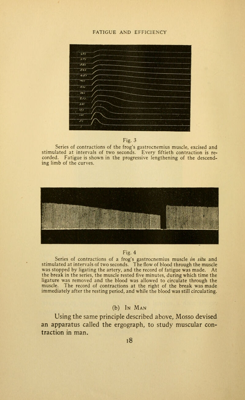 Fig. 3 Series of contractions of the frog's gastrocnemius muscle, excised and stimulated at intervals of two seconds. Every fiftieth contraction is re- corded. Fatigue is shown in the progressive lengthening of the descend- ing limb of the curves. Fig. 4 Series of contractions of a frog's gastrocnemius muscle in situ and stimulated at intervals of two seconds. The flow of blood through the muscle was stopped by ligating the artery, and the record of fatigue was made. At the break in the series, the muscle rested five minutes, during which time the ligature was removed and the blood was allowed to circulate through the muscle. The record of contractions at the right of the break was made immediately after the resting period, and while the blood was still circulating. (b) In Man Using the same principle described above, Mosso devised an apparatus called the ergograph, to study muscular con- traction in man. i8