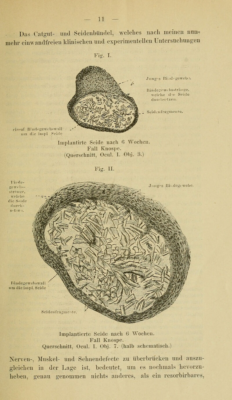 Das Catgiit- nud Seidcnbiindel, welches nach meinen nnn- mehr eimvandfreien klinischen nnd experimentellen Untersuchimgen Fiff. I. ruf r.'llili-^ewi'bswrill \iin die iiupl Sc-iile welplie ile Seiile (liiivlisi'tzeii. _ , St-'iiluiif'.'aijineiiie. Imrlantirtc Seide uach ß AYochen. Fall Knospe. (Querschnitt, Ocnl. I. Obj. 3.) Fijr. II. Ji 1 ^ s lii (Il^i nebc- Implantierte Seide nach 6 Wochen. Fall Knospe. Querschnitt, Ocul. I. Obj. 7. (halb schematisch.) Nerven-, Muskel- nnd Sehnendefecte zu überbrücken nnd auszu- gleichen in der Lage ist, bedeutet, um es nochmals hevorzu- heben, genau genommen nichts anderes, als ein resorbirbares,