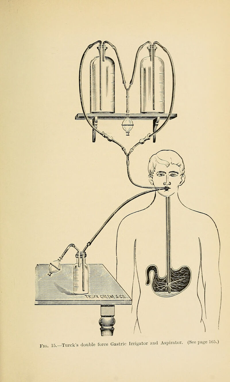 J. 15.-Turck's double force Gastric Irrigator and Aspirator. (See page 1(55.)