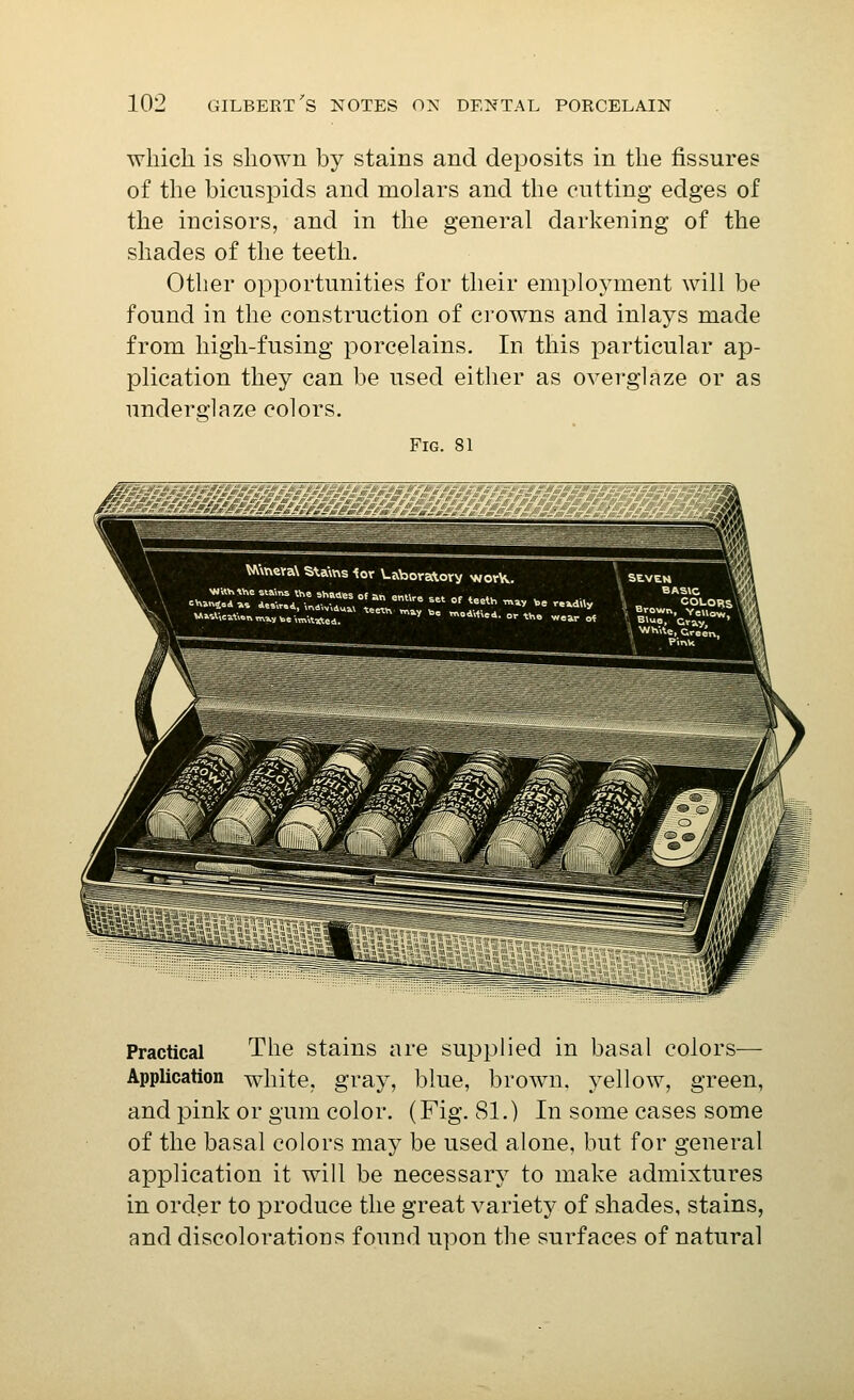 which is shown by stains and deposits in the fissures of the bicuspids and molars and the cutting edges of the incisors, and in the general darkening of the shades of the teeth. Other opportunities for their employment will be found in the construction of crowns and inlays made from high-fusing porcelains. In this particular ap- plication they can be used either as overglaze or as underglaze colors. Fig. 81 Practical The stains are supplied in basal colors— Application white, gray, blue, brown, yellow, green, and pink or gum color. (Fig. 81.) In some cases some of the basal colors may be used alone, but for general application it will be necessary to make admixtures in order to produce the great variety of shades, stains, and discolorations found upon the surfaces of natural