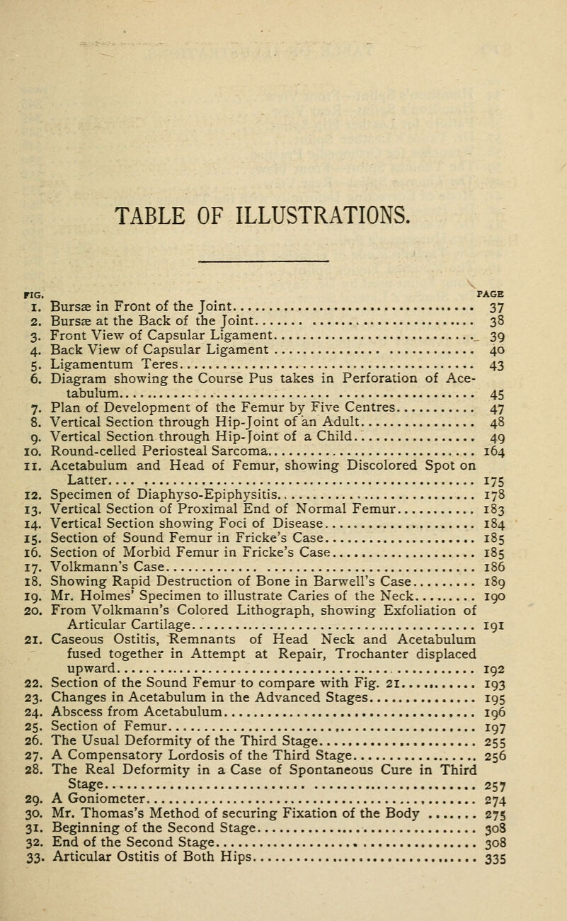 TABLE OF ILLUSTRATIONS. riG. PAGE 1. Bursse in Front of the Joint 37 2. Bursae at the Back of the Joint 38 3. Front View of Capsular Ligament _ 39 4. Back View of Capsular Ligament 40 5. Ligamentum Teres 43 6. Diagram showing the Course Pus takes in Perforation of Ace- tabulum 45 7. Plan of Development of the Femur by Five Centres 47 8. Vertical Section through Hip-Joint of an Adult 48 9. Vertical Section through Hip- Joint of a Child 49 10. Round-celled Periosteal Sarcoma 164 11. Acetabulum and Head of Femur, showing Discolored Spot on Latter , 175 12. Specimen of Diaphyso-Epiphysitis , 178 13. Vertical Section of Proximal End of Normal Femur 183 14. Vertical Section showing Foci of Disease 184 15. Section of Sound Femur in Fricke's Case 185 16. Section of Morbid Femur in Fricke's Case 185 17. Volkmann's Case 186 18. Showing Rapid Destruction of Bone in Barwell's Case 189 19. Mr. Holmes' Specimen to illustrate Caries of the Neck 190 20. From Volkmann's Colored Lithograph, showing Exfoliation of Articular Cartilage. 191 21. Caseous Ostitis, Remnants of Head Neck and Acetabulum fused together in Attempt at Repair, Trochanter displaced upward 192 22. Section of the Sound Femur to compare with Fig. 21 193 23. Changes in Acetabulum in the Advanced Stages 195 24. Abscess from Acetabulum 196 25. Section of Femur 197 26. The Usual Deformity of the Third Stage 255 27. A Compensatory Lordosis of the Third Stage 256 28. The Real Deformity in a Case of Spontaneous Cure in Third Stage.. 257 29. A Goniometer 274 30. Mr. Thomas's Method of securing Fixation of the Body 275 31. Beginning of the Second Stage 30S 32. End of the Second Stage 308 33. Articular Ostitis of Both Hips 335