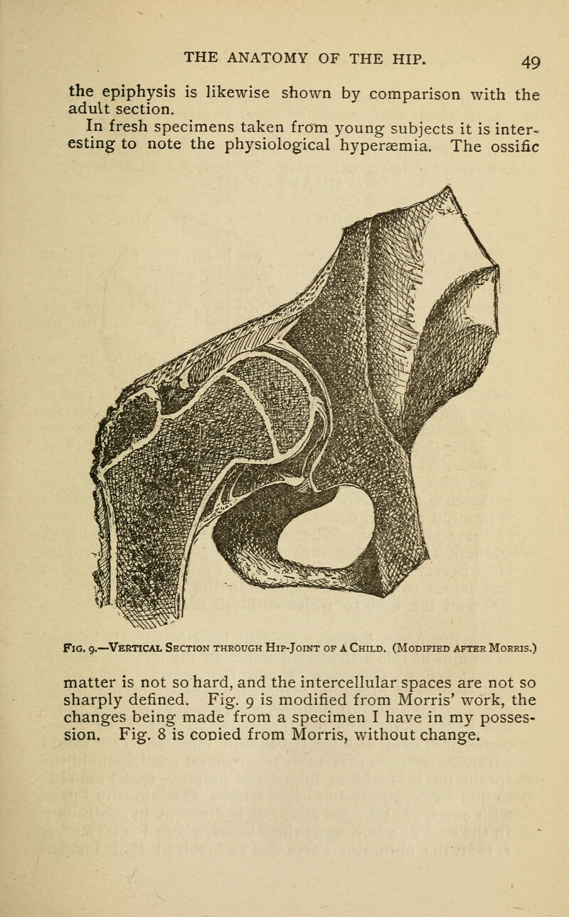 the epiphysis is likewise shown by comparison with the adult section. In fresh specimens taken from young subjects it is inter> esting to note the physiological hypersemia. The ossific Fig. 9.—Vertical Section through Hip-Joint of a Child. (Modified after Morris.) matter is not so hard, and the intercellular spaces are not so sharply defined. Fig. 9 is modified from Morris' work, the changes being made from a specimen I have in my posses- sion. Fig. 8 is cocied from Morris, without change.