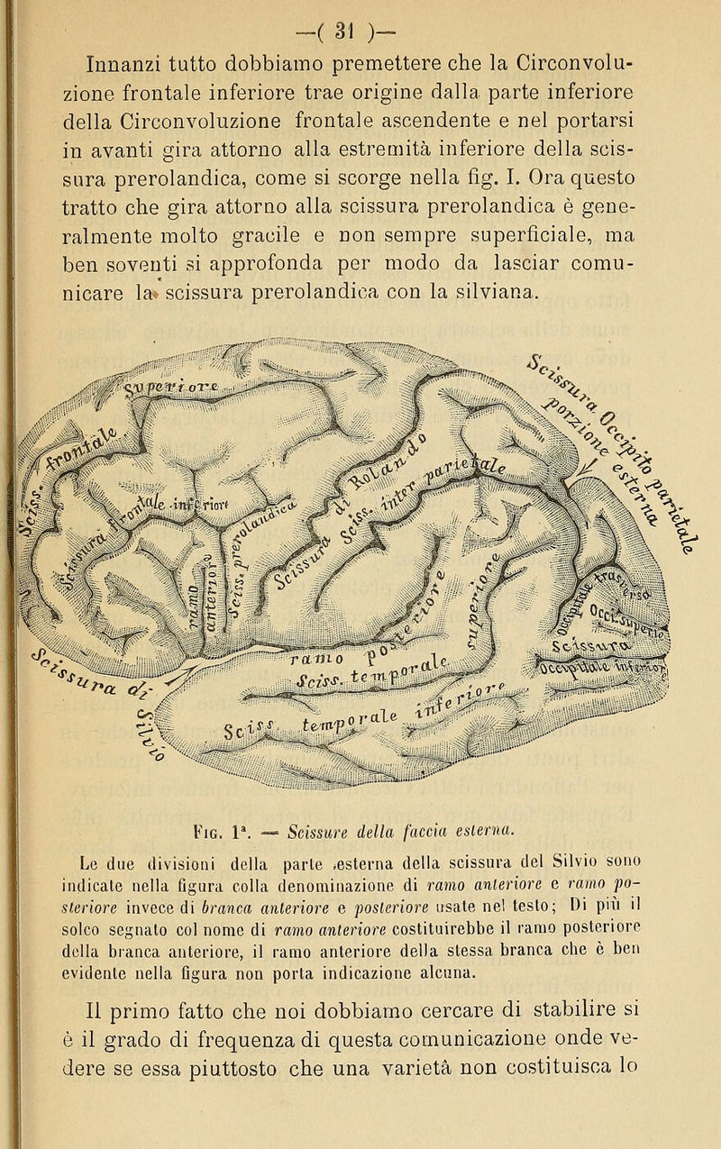 Innanzi tutto dobbiamo premettere che la Circonvolu- zione frontale inferiore trae origine dalla parte inferiore della Circonvoluzione frontale ascendente e nel portarsi in avanti gira attorno alla estremità inferiore della scis- sura prerolandica, come si scorge nella fig. I. Ora questo tratto che gira attorno alla scissura prerolandica è gene- ralmente molto gracile e non sempre superficiale, ma ben soventi si approfonda per modo da lasciar comu- nicare la* scissura prerolandica con la silviana. '•^s ^^■y--- ramo /2\^^^^^ ^^r Sc^!t..^'^'^-'''^'v-' Ì,i ^ *^br. FiG. V. —= Scissure della faccia esterna. Le due divisioni della parie -esterna della scissura del Silvio sono indicate nella figura colla denominazione di ramo anteriore e ramo po- steriore invece di branca anteriore e posteriore usate nel testo; Di piu il solco segnato col nome di ramo anteriore costituirebbe il ramo posteriore della branca anteriore, il ramo anteriore della stessa branca che è ben evidente nella figura non porta indicazione alcuna. Il primo fatto che noi dobbiamo cercare di stabilire si è il grado di frequenza di questa comunicazione onde ve- dere se essa piuttosto che una varietà non costituisca lo