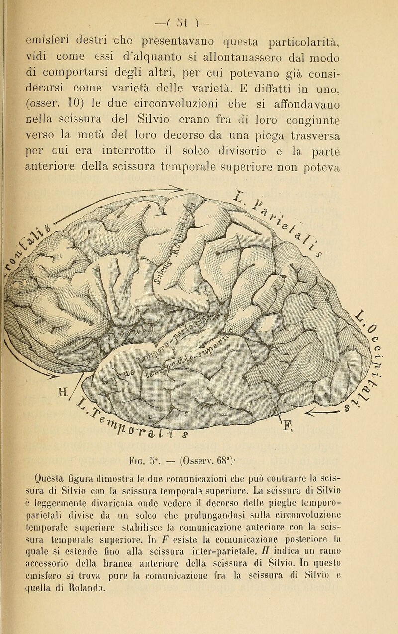 emisferi destri che presentavano questa particolarità, vidi come essi d'alquanto si allontanassero dal modo di comportarsi degli altri, per cui potevano già consi- derarsi come varietà delle varietà. E diffàtti in uno, (esser. 10) le due circonvoluzioni che si affondavano nella scissura del Silvio erano fra di loro congiunte verso la metà del loro decorso da una piega trasversa per cui era interrotto il solco divisorio e la parte anteriore della scissura temporale superiore non poteva ^òT^^ttr^ FiG. 5'. — (Osserv. 68']- Questa figura dimostra le due comunicazioni che può contrarre la scis- sura di Silvio con la scissura temporale superiore. La scissura di Silvio è leggermente divaricala onde vedere il decorso delle pieghe temporo- parietali divise da un solco che prolungandosi sulla circonvoluzione temporale superiore stabilisce la comunicazione anteriore con la scis- sura temporale superiore. In F esiste la comunicazione posteriore la quale si estende fino alla scissura inter-parielale. H indica un ramo accessorio della branca anteriore della scissura di Silvio. In questo emisfero si trova pure la comunicazione fra la scissura di Silvio e quella di Rolando.