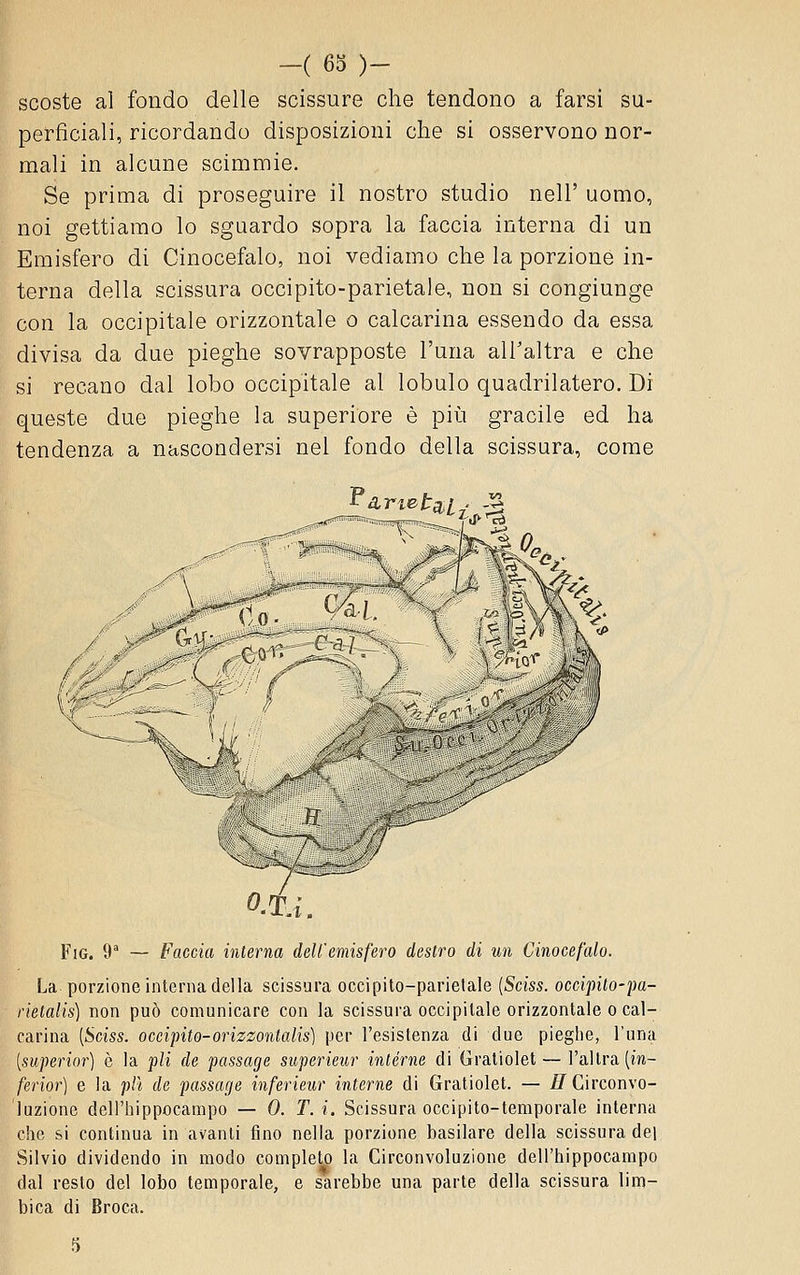 scoste al fondo delle scissure che tendono a farsi su- perficiali, ricordando disposizioni che si osservono nor- mali in alcune scimmie. Se prima di proseguire il nostro studio nell' uomo, noi gettiamo lo sguardo sopra la faccia interna di un Emisfero di Cinocefalo, noi vediamo che la porzione in- terna della scissura occipite-parietale, non si congiunge con la occipitale orizzontale o calcarina essendo da essa divisa da due pieghe sovrapposte l'una all'altra e che si recano dal lobo occipitale al lobulo quadrilatero. Di queste due pieghe la superiore è più gracile ed ha tendenza a nascondersi nei fondo della scissura, come 'Pa,rtetani. -^ -^ ■— ~—ir~'~-^f''' 3 ' - -^ T ■' \ ^ L'I A .' i^ii^^t^'v k FiG. 9^ — Faccia interna dell'emisfero destro di un Cinocefalo. La porzione interna della scissura occipito-parietale [Sciss. occipito-pa- rielalis) non può comunicare con la scissura occipitale orizzontale o cal- carina [Sciss. oceipito-orizzontalis] per l'esistenza di due pieghe, l'una [superiar] è la pli de passage superieur intèrne di Oratiolet — l'altra (m- ferior] e la plì de passage inferieur interne di Gratiolet. — //Circonvo- luzione dell'hippocampo — 0. T. i. Scissura occipito-temporale interna che si continua in avanti fino nella porzione basilare della scissura del Silvio dividendo in modo completo la Circonvoluzione dell'hippocampo dal resto del lobo temporale, e sarebbe una parte della scissura lim- bica di Broca.