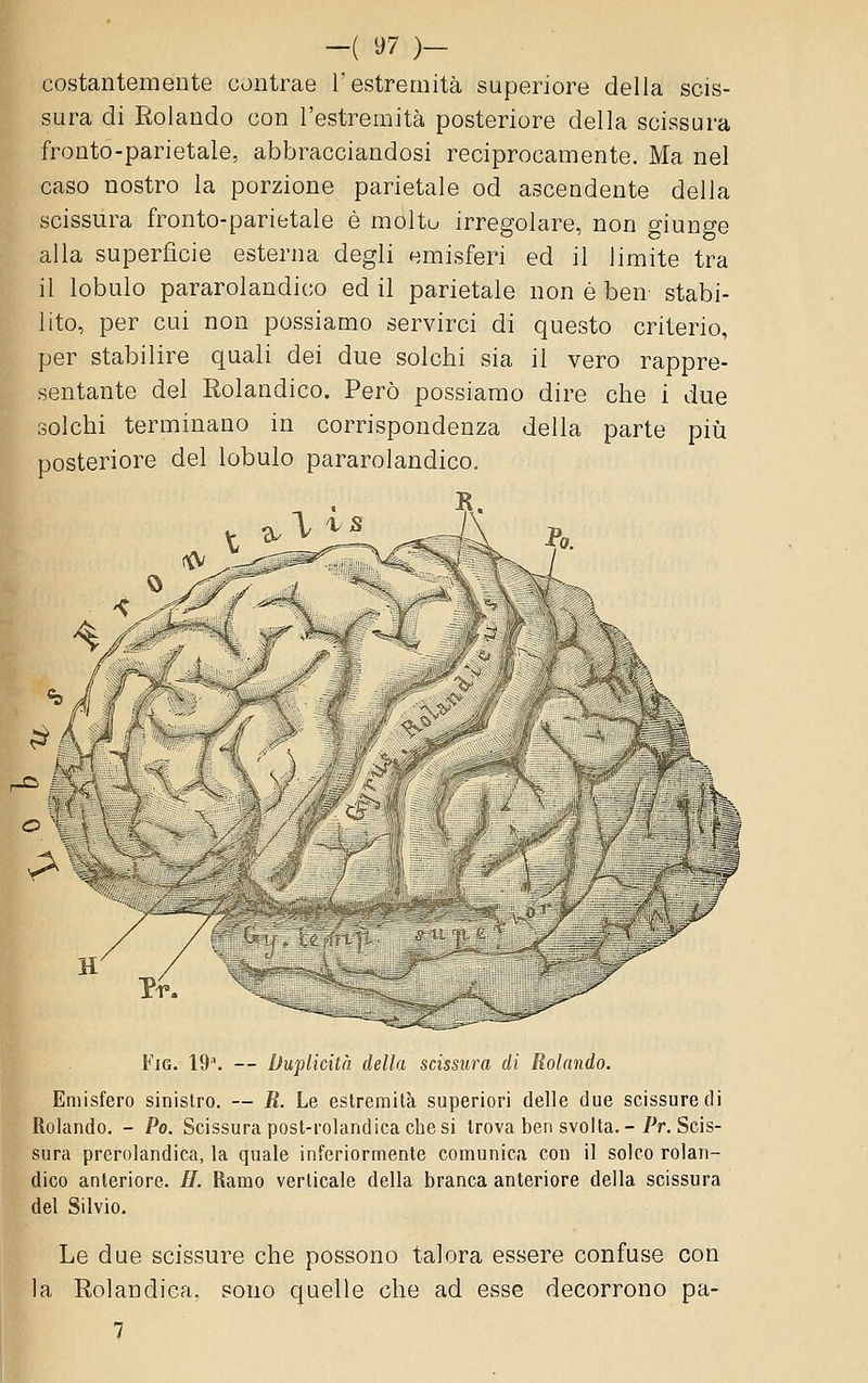 costantemente contrae l'estremità superiore della scis- sura di Rolando con l'estremità posteriore della scissura fronto-parietale, abbracciandosi reciprocamente. Ma nel caso nostro la porzione parietale od ascendente della scissura fronto-parietale è moltu irregolare, non giunge alla superficie esterna degli emisferi ed il limite tra il lobulo pararolandico ed il parietale non è ben' stabi- lito, per cui non possiamo servirci di questo criterio, per stabilire quali dei due solchi sia il vero rappre- sentante del Rolandico. Però possiamo dire che i due solchi terminano in corrispondenza della parte più posteriore del lobulo pararolandico. f V mm>^ FiG. 19'. — Duplicità della scissura di Rolando. Emisfero sinistro. — R. Le estremità superiori delle due scissure di Rolando. - Po. Scissura post-rolandica che si trova ben svolta. -/V. Scis- sura prerolandica, la quale inferiormente comunica con il solco rolan- dico anteriore. H. Ramo verticale della branca anteriore della scissura del Silvio. Le due scissure che possono talora essere confuse con la Rolandica, sono quelle che ad esse decorrono pa- 7