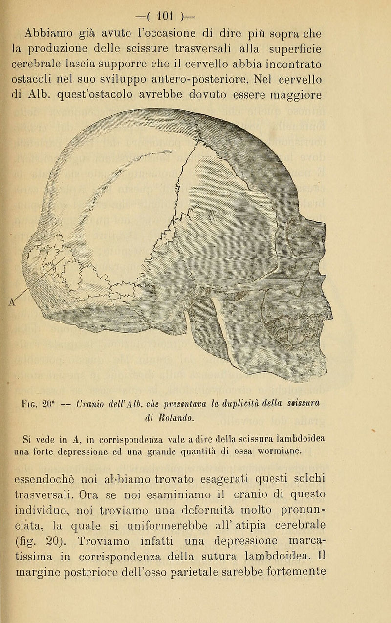 Abbiamo già avuto l'occasione di dire più sopra che la produzione delle scissure trasversali alla superficie cerebrale lascia supporre che il cervello abbia incontrato ostacoli nel suo sviluppo antero-posteriore. Nel cervello di Alb. quest'ostacolo avrebbe dovuto essere maggiore 0 iàr s. /\ Tte _j?=tV / t^  ' / M '\ 1 #*^ L/^' Xr^^ì^'r r^ FiG. 20* — Cranio deWAlb. che presentava la duplicità della siisstira di Rolando. Si vede in A, in corrispondenza vale a dire della scissura lambdoidea lina forte depressione ed una grande quantità di ossa worniiane. essendoché noi abbiamo trovato esagerati questi solchi trasversali. Ora se noi esaminiamo il cranio di questo individuo, noi troviamo una deformità molto pronun- ciata, la quale si uniformerebbe all' atipia cerebrale (fig. 20). Troviamo infatti una depressione marca- tissiraa in corrispondenza della sutura lambdoidea. Il margine posteriore dell'osso parietale sarebbe fortemente