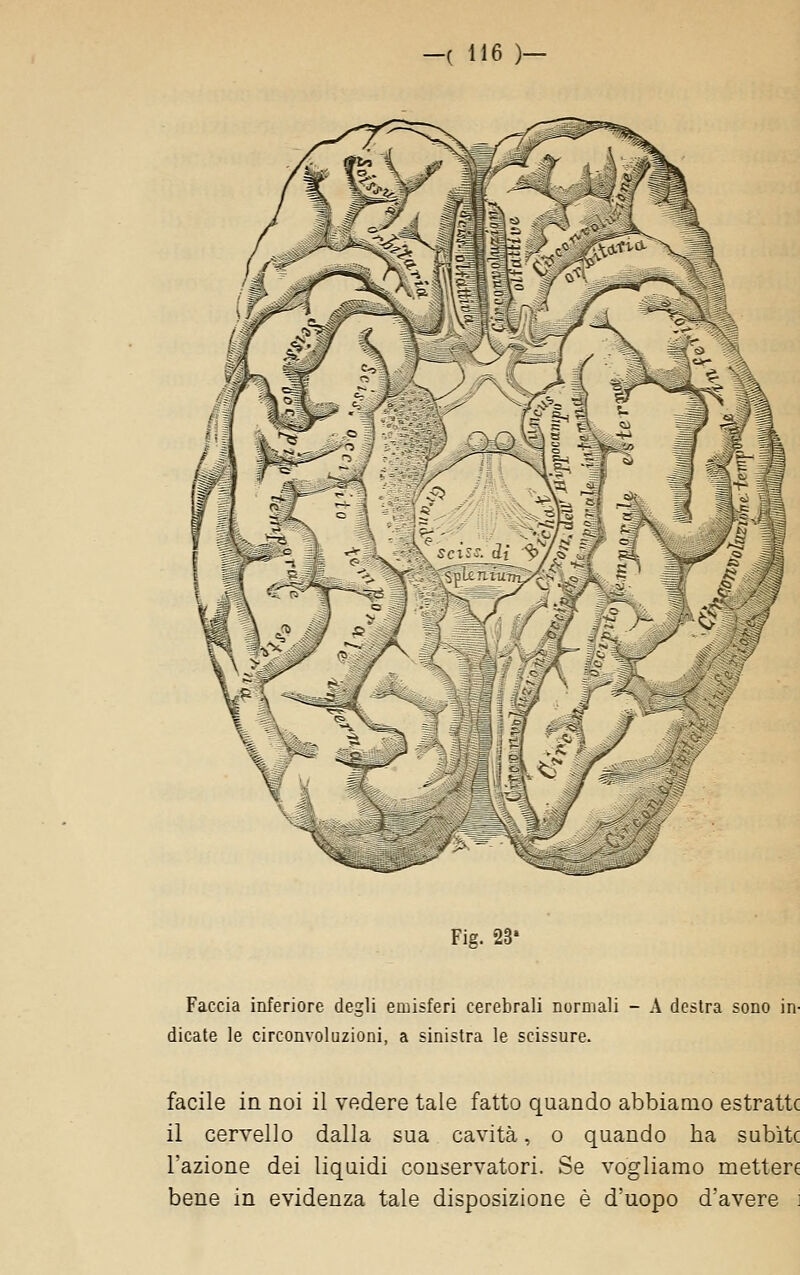 Fig. 23* Faccia inferiore degli eiiiisferi cerebrali normali - A destra sono in- dicate le circonvoluzioni, a sinistra le scissure. facile in noi il vedere tale fatto quando abbiamo estrattc il cervello dalla sua cavità, o quando ha subite l'azione dei liquidi conservatori. Se vogliamo mettere bene in evidenza tale disposizione è d'uopo d'avere i