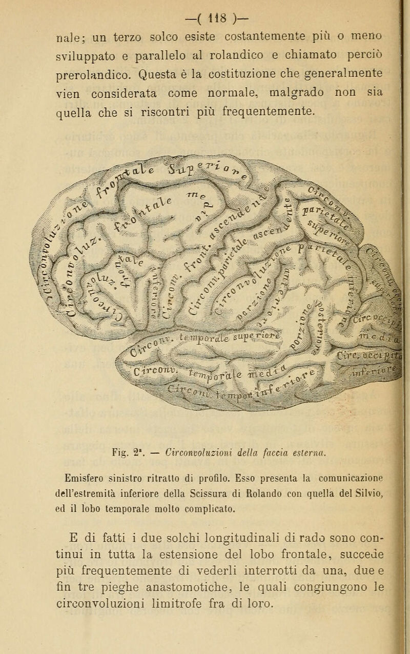 naie; un terzo solco esiste costantemente più o meno sviluppato e parallelo al rolandico e chiamato perciò prerolandico. Questa è la costituzione che generalmente vien considerata come normale, malgrado non sia quella che si riscontri più frequentemente. —^\s*. Fig. 2*. — Circonvoluzioni della faccia esterna. Emisfero sinistro ritratto di profilo. Esso presenta la comunicazione ddl'eslreraità inferiore della Scissura di Rolando con quella del Silvio, ed il lobo temporale mollo complicato. E di fatti i due solchi longitudinali di rado sono con- tinui in tutta la estensione del lobo frontale, succede più frequentemente di vederli interrotti da una, due e fin tre pieghe anastomotiche, le quali congiungono le circonvoluzioni limitrofe fra di loro.