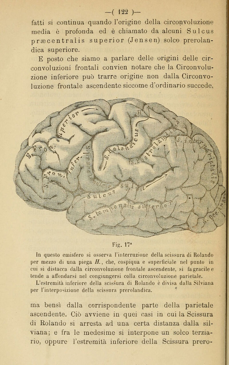 fatti si continua quando l'origine della circonvoluzione media è profonda ed è chiamato da alcuni Sulcus prsecentraiis superi or (Jensen) solco prerolan- dica superiore. E posto che siamo a parlare delle origini delle cir- convoluzioni frontali convien notare che la Circonvolu- zione inferiore può trarre origine non dalla Circonvo- luzione frontale ascendente siccome d'ordinario succede, :-flM ;*« Fig. 17' In questo emisfero si osserva l'interruzione della scissura di Rolando per mezzo di una piega H., che, cospiqua e superficiale nel punto in cui si distacca dalla circonvoluzione frontale ascendente, si fagracilee tende a affondarsi nel congiungersi colla circonvoluzione parietale. L'estremità inferiore della scissura di Rolando è divisa dalla Silviana per l'interposizione della scissura prerolandica. ma bensì dalla corrispondente parte della parietale ascendente. Ciò avviene in quei casi in cui la Scissura di Rolando si arresta ad una certa distanza dalla sil- viana; e fra le medesime si interpone un solco terzia- rio, oppure l'estremità inferiore della Scissura prero-