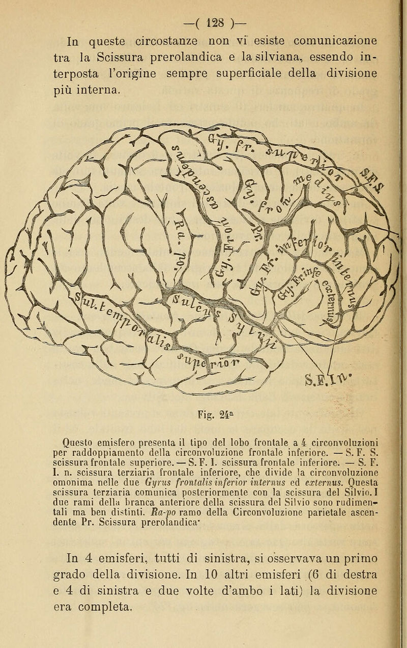 la queste circostanze non vi esiste comunicazione tra la Scissura prerolandica e la silviana, essendo in- terposta l'origine sempre superficiale della divisione più interna. Fig. 24^ Questo emisfero presenta il tipo del lobo frontale a 4 circonvoluzioni per raddoppiamento della circonvoluzione frontale inferiore. —S. F. vS. scissura frontale superiore. — S. F. I. scissura frontale inferiore. — S. F. I. n. scissura terziaria frontale inferiore, che divide la circonvoluzione omonima nelle due Gyrus frontalis inferior internus ed externus. Questa scissura terziaria comunica posteriormente con la scissura del Silvio. I due rami della branca anteriore della scissura del Silvio sono rudimen- tali ma ben distinti. Ra-po ramo della Circonvoluzione parietale ascen- dente Pr. Scissura prerolandica* In 4 emisferi, tutti di sinistra, si osservava un primo grado della divisione. In 10 altri emisferi (6 di destra e 4 di sinistra e due volte d'ambo i lati) la divisione era completa.