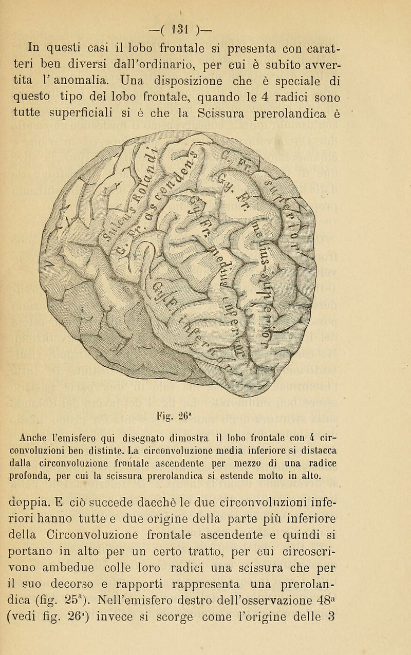 In questi casi il lobo frontale si presenta con carat- teri ben diversi dalTordinario, per cui è subito avver- tita l'anomalia. Una disposizione che è speciale di questo tipo del lobo frontale, quando le 4 radici sono tutte superficiali si è che la Scissura prerolandica è Fig. ^G Anche l'emisfero qui disegnato dimostra il lobo frontale con 4 cir- convoluzioni ben distinte. La circonvoluzione media inferiore si distacca dalla circonvoluzione frontale ascendente per mezzo di una radice profonda, per cui la scissura prerolandica si estende molto in alto. doppia. E ciò succede dacché le due circonvoluzioni infe- riori hanno tutte e due origine della parte piìi inferiore delia Circonvoluzione frontale ascendente e quindi si portano in alto per un certo tratto, per cui circoscri- vono ambedue colle loro radici una scissura che per il suo decorso e rapporti rappresenta una prerolan- dica (fig. 25^). Nell'emisfero destro dell'osservazione 48^ (vedi fig. 26) invece si scorge come l'origine delle 3