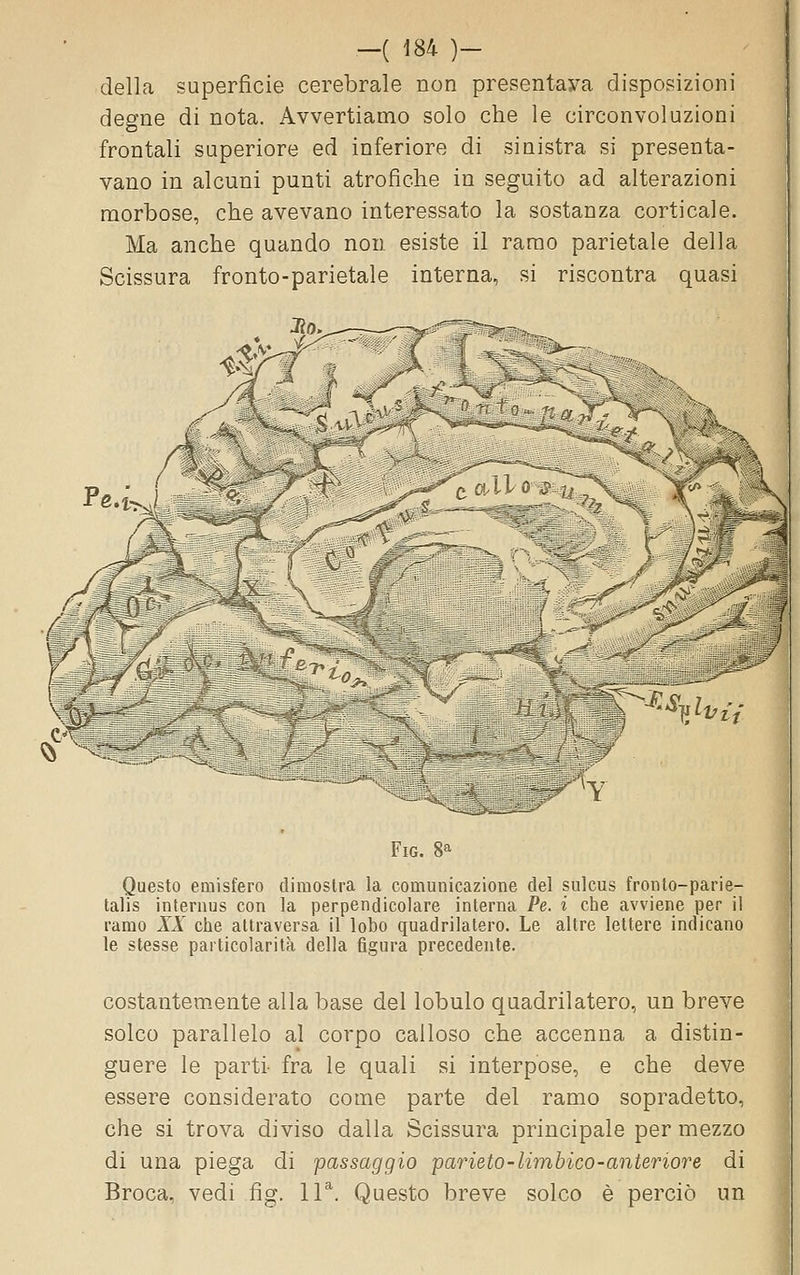 della superficie cerebrale non presentava disposizioni degne di nota. Avvertiamo solo che le circonvoluzioni frontali superiore ed inferiore di sinistra si presenta- vano in alcuni punti atrofiche in seguito ad alterazioni morbose, che avevano interessato la sostanza corticale. Ma anche quando non esiste il ramo parietale della Scissura fronto-parietale interna, si riscontra quasi rm ^^^'^^Ivii w^ FiG. 8^ Questo emisfero dimostra la comunicazione del sulcus fronto-parie- talis internus con la perpendicolare interna Pe. % che avviene per il ramo XX che attraversa il lobo quadrilatero. Le altre lettere indicano le stesse particolarità della figura precedente. costantemente alla base del lobulo quadrilatero, un breve solco parallelo al corpo calloso che accenna a distin- guere le parti- fra le quali si interpose, e che deve essere considerato come parte del ramo sopradetto, che si trova diviso dalla Scissura principale per mezzo di una piega di passaggio parieto-limbico-anteriore di Broca. vedi fìg. 11*. Questo breve solco è perciò un