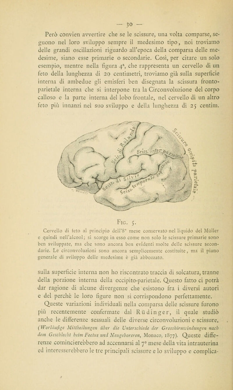 Però convien avvertire che se le scissure, una volta comparse, se- guono nel loro sviluppo sempre il medesimo tipo, noi troviamo delle grandi oscillazioni riguardo all'epoca della comparsa delle me- desime, siano esse primarie o secondarie. Cosi, per citare un solo esempio, mentre nella figura 4% che rappresenta un cervello di un feto della lunghezza di 20 centimetri, troviamo già sulla superficie interna di ambedue gli emisferi ben disegnata la scissura fronto- parietale interna che si interpone tra la Circonvoluzione del corpo calloso e la parte interna del lobo frontale, nel cervello di un altro feto più innanzi nel suo sviluppo e della lunghezza di 25 centim. Fig. 5. Cervello di feto al principio dell'8 mese conservato nel liquido del Mùller e quindi nell'alcool; si scorge in esso come non solo le scissure primarie sono ben sviluppate, ma che sono ancora ben evidenti molte delle scissure secon- darie. Le circonvoluzioni sono ancora semplicemente costituite, ma il piano generale di sviluppo delle medesime è già abbozzato. sulla superficie interna non ho riscontrato traccia di solcatura, tranne della porzione interna della occipito-parietale. Questo fatto ci potrà dar ragione di alcune divergenze che esistono fra i diversi autori e del perchè le loro figure non si corrispondono perfettamente. Queste variazioni individuali nella comparsa delle scissure furono più recentemente confermate dal Rti diriger, il quale studiò anche le differenze sessuali delle diverse circonvoluzioni e scissure. (Worlàufige Miltheilungen ùber die Unterschiede der Grosshirmvindungen nach dem Geschlecht beim Foctus imi Neugeboreren, Monaco, 1877). Queste diffe- renze comincierebbero ad accennarsi al 70 mese della vita intrauterina ed interesserebbero le tre principali scissure e lo sviluppo e complica-