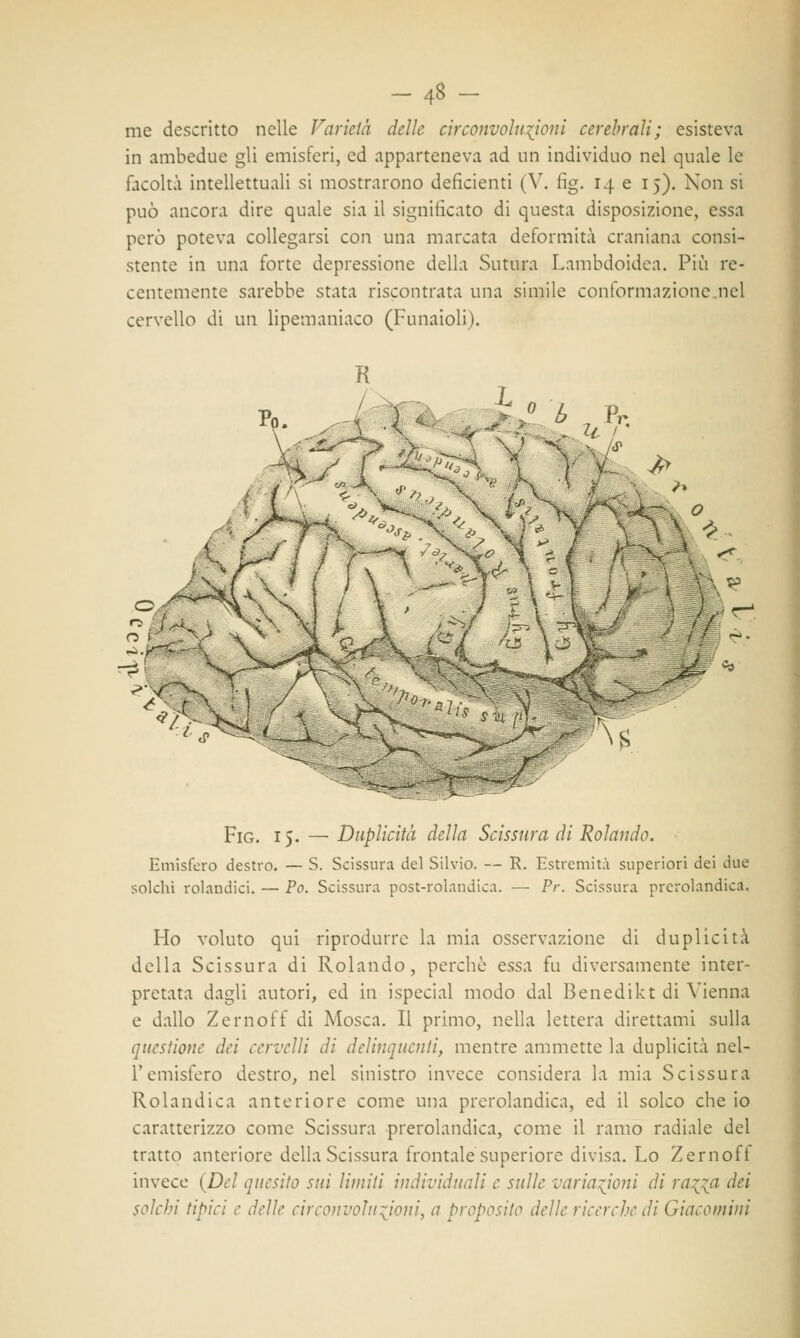 -4» - me descritto nelle Varietà delle circonvoluzioni cerebrali; esisteva in ambedue gli emisferi, ed apparteneva ad un individuo nel quale le facoltà intellettuali si mostrarono deficienti (V. fig. 14 e 15). Non si può ancora dire quale sia il significato di questa disposizione, essa però poteva collegarsi con una marcata deformità craniana consi- stente in una forte depressione della Sutura Lambdoidea. Più re- centemente sarebbe stata riscontrata una simile conformazione nel cervello di un lipemaniaco (Funaioli). e. > 1 >> *0\ o v Fig. 15. — Duplicità della Scissura di Rolando. Emisfero destro. — S. Scissura del Silvio. — R. Estremità superiori dei due solchi rolandici. — Po. Scissura post-rolandica. — Pr. Scissura prerolandica. Ho voluto qui riprodurre la mia osservazione di duplicità della Scissura di Rolando, perchè essa fu diversamente inter- pretata dagli autori, ed in ispecial modo dal Benedikt di Vienna e dallo Zernoff di Mosca. Il primo, nella lettera direttami sulla questione dei cervelli di delinquenti, mentre ammette la duplicità nel- Vemisfero destro, nel sinistro invece considera la mia Scissura Rolandica anteriore come una prerolandica, ed il solco che io caratterizzo come Scissura prerolandica, come il ramo radiale del tratto anteriore della Scissura frontale superiore divisa. Lo Zernoff invece (Del quesito sui limiti individuali e sulle variazioni di ra^a dei solchi tipici e delle circonvoluzioni, a proposito delle ricerche di Giacomini