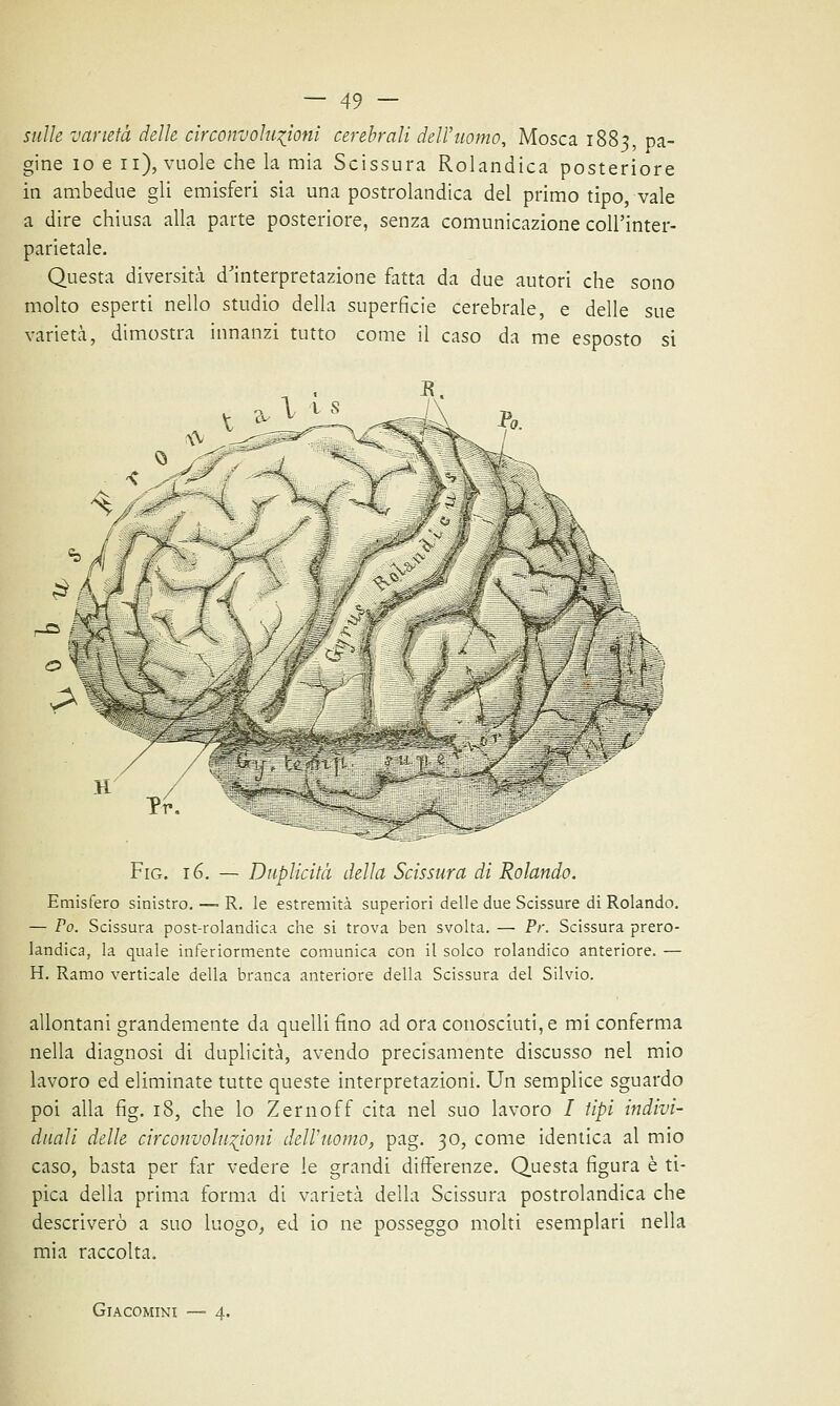 sulle varietà delle circonvoluzioni cerebrali dell'uomo, Mosca 1883, pa- gine io e 11), vuole che la mia Scissura Rolandica posteriore in ambedue gli emisferi sia una postrolandica del primo tipo, vale a dire chiusa alla parte posteriore, senza comunicazione coll'inter- parietale. Questa diversità d'interpretazione fatta da due autori che sono molto esperti nello studio della superficie cerebrale, e delle sue varietà, dimostra innanzi tutto come il caso da me esposto si Fig. 16. — Duplicità della Scissura di Rolando. Emisfero sinistro. — R. le estremità superiori delle due Scissure di Rolando. — Po. Scissura post-rolandica che si trova ben svolta. — Pr. Scissura prero- landica, la quale inferiormente comunica con il solco rolandico anteriore. — H. Ramo verticale della branca anteriore della Scissura del Silvio. allontani grandemente da quelli fino ad ora conosciuti, e mi conferma nella diagnosi di duplicità, avendo precisamente discusso nel mio lavoro ed eliminate tutte queste interpretazioni. Un semplice sguardo poi alla fig. 18, che lo Zernoff cita nel suo lavoro / tipi indivi- duali delle circonvoluzioni dell'uomo, pag. 30, come identica al mio caso, basta per far vedere le grandi differenze. Questa figura è ti- pica della prima forma di varietà della Scissura postrolandica che descriverò a suo luogo, ed io ne posseggo molti esemplari nella mia raccolta. Giacomini —■ 4.