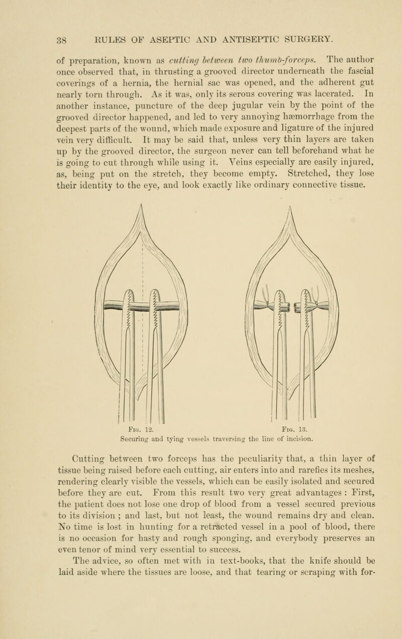 of preparation, known as cutting between two thumb-forceps. The author once observed that, in thrusting a grooved director underneath the fascial coverings of a hernia, the hernial sac was opened, and the adherent gut nearly torn through. As it was, only its serous covering was lacerated. In another instance, puncture of the deep jugular vein by the point of the grooved director happened, and led to very annoying haemorrhage from the deepest parts of the wound, which made exposure and ligature of the injured vein very difficult. It may be said that, unless very thin layers are taken up by the grooved director, the surgeon never can tell beforehand what he is going to cut through while using it. Veins especially are easily injured, as, being put on the stretch, they become empty. Stretched, they lose their identity to the eye, and look exactly like ordinary connective tissue. Fig. 12. Fio. 13. Securing and tying vessels traversing the line of incision. Cutting between two forceps has the peculiarity that, a thin layer of tissue being raised before each cutting, air enters into and rarefies its meshes, rendering clearly visible the vessels, which can be easily isolated and secured before they are cut. From this result two very great advantages : First, the patient does not lose one drop of blood from a vessel secured previous to its division ; and last, but not least, the wound remains dry and clean. No time is lost in hunting for a retracted vessel in a pool of blood, there is no occasion for hast}^ and rough sponging, and everybody preserves an even tenor of mind very essential to success. The advice, so often met with in text-books, that the knife should be laid aside where the tissues are loose, and that tearing or scraping with for-