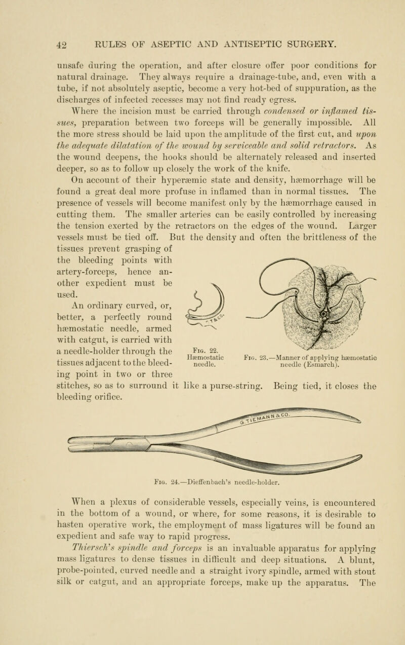 unsafe during the operation, and after closure offer poor conditions for natural drainage. They alwaA^s require a drainage-tube, and, even with a tube, if not absolutely aseptic, become a very hot-bed of suj)puration, as the discharges of infected recesses may not find ready egress. Where the incision must be carried through condensed or i7ijlamed tis- sues, preparation between two forceps will be generally impossible. All the more stress should be laid upon the amplitude of the first cut, and upon the adequate dilatation of the wound by serviceable and solid retractors. As the wound deepens, the hooks should be alternately released and inserted deeper, so as to follow up closely the work of the knife. On account of their hypersemic state and density, haemorrhage will be found a great deal more profuse in inflamed than in normal tissues. The presence of vessels will become manifest only by the haemorrhage caused in cutting them. The smaller arteries can be easily controlled by increasing the tension exerted by the retractors on the edges of the wound. Larger vessels must be tied off. But the density and often the brittleness of the tissues prevent grasping of the bleeding points with artery-forceps, hence an- other expedient must be used. An ordinary curved, or, better, a perfectly round haemostatic needle, armed with catgut, is carried with a needle-holder through the tissues adjacent to the bleed- ing point in two or three stitches, so as to surround it like a purse-string. Being tied, it closes the bleeding orifice. Fig. 22. Haemostatic needle. Fig. 23. Manner of applying haemostatic needle (Esmarcli). When a plexus of considerable vessels, especially veins, is encountered in the bottom of a wound, or where, for some reasons, it is desirable to hasten operative work, the employment of mass ligatures will be found an expedient and safe way to rapid progress. ThierscJi's spindle and forceps is an invaluable apparatus for applying mass ligatures to dense tissues in difficult and deep situations. A blunt, probe-pointed, curved needle and a straight ivory spindle, armed with stout silk or catgut, and an appropriate forceps, make up the apparatus. The