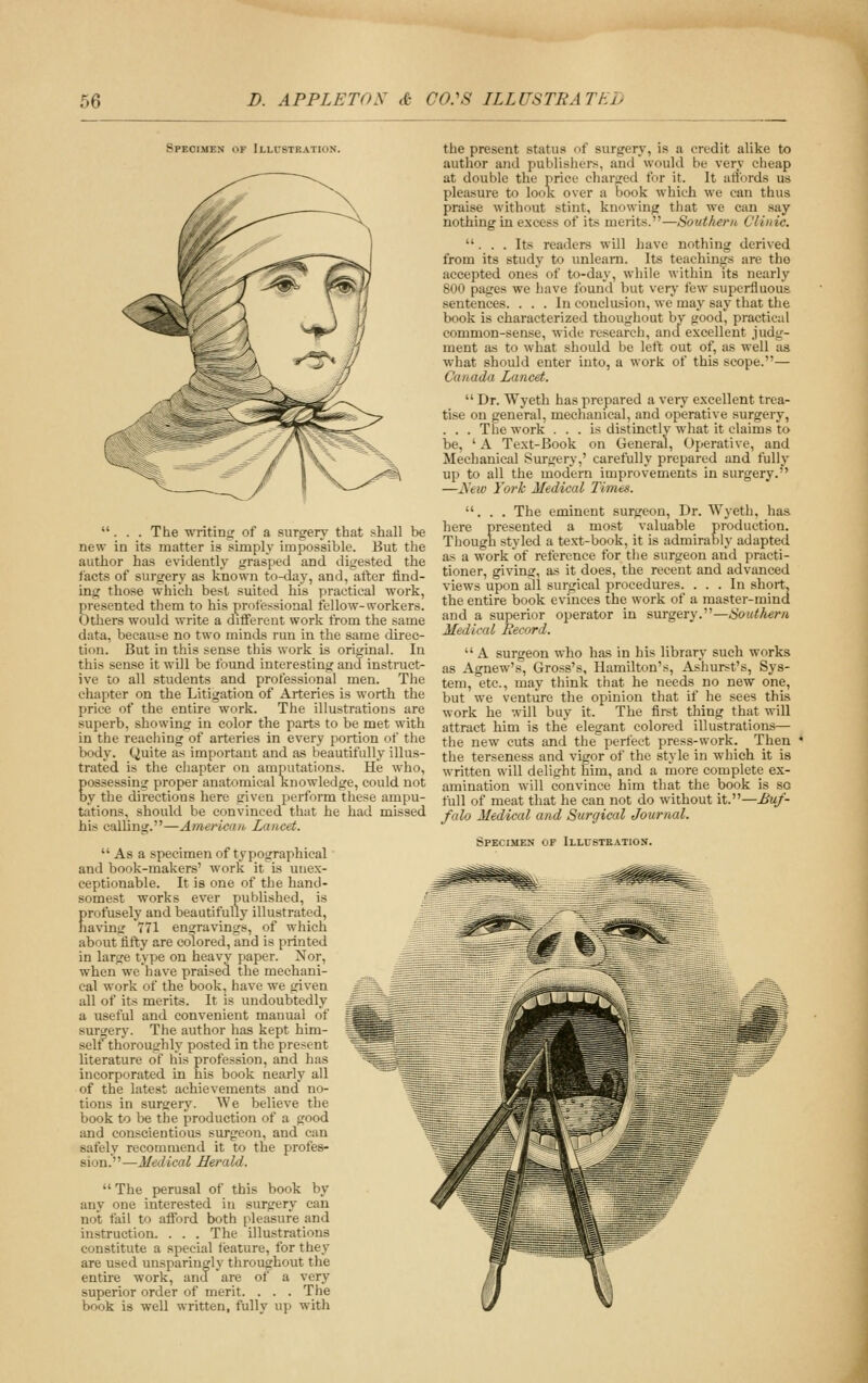 Specimen of Illubtkation. ... The writint' of a surgery that .shall be new in its matter is simply impossible. But the author has evidently grasped and digested the facts of surgery as known to-day, and, after find- ing those which best suited his practical work, presented them to his professional fellow-workers. Others would write a different work from the same data, because no two minds run in the same direc- tion. But in this sense this work is original. In this sense it will be found interesting and instruct- ive to all students and professional men. The chapter on the Litigation of Arteries is worth the price of the entire work. The illustrations are superb, showing in color the parts to be met with in the reaching of arteries in every portion of the body. Quite as important and as beautifully illus- trated is the chapter on amputations. He who, Eossessing proper anatomical knowledge, could not y the directions here given perform these ampu- tations, should be convinced that he had missed his calling.—American Lancet.  As a specimen of typographical and book-makers' work it is unex- ceptionable. It is one of the hand- somest works ever published, is profusely and beautifully illustrated, having 771 engravings, of which about fifty are colored, and is printed in large type on heavy paper. Nor, when we have praised the mechani- cal work of the book, have we given all of its merits. It is undoubtedly a useful and convenient manual of surgery. The author has kept him- self thoroughly posted in the present literature of his profession, and has incorporated in his book nearly all of the latest achievements and no- tions in surgery. We believe the book to be the production of a good and conscientious surgeon, and can safely recommend it to the profes- sion.—Medical Herald. The perusal of this book by any one interested in surgery can not fail to afford both pleasure and instruction. . . . The illustrations constitute a special feature, for they are used unsparingly throughout the entire work, and are of a very superior order of merit. . . . The book is well written, fully up with the present status of surgery, is a credit alike to author and publishers, and would be very cheap at double the price chartred for it. It affords us pleasure to look over a book which we can thus praise without stint, knowing that we can say nothing iu excess of its merits.—Southern Clinic. ... Its readers will have nothing derived from its study to unlearn. Its teachings are the accepted ones of to-day, while within its nearly 800 pages we have found but very few superfluous .sentences. ... In conclusion, we may say that the book is characterized thoughout by good, practical common-sense, wide research, and excellent .iudg- ment as to what should be left out of, as well as what should enter into, a work of this scope.— Canada Lancet.  Dr. Wyeth has prepared a very excellent trea- tise on general, mechanical, and operative surgery, . . . The work ... is distinctly what it claims to be, 'A Text-Book on General, Operative, and Mechanical Surgery,' carefully prepared and fully up to all the modern improvements in surgery. —A'ew York Medical Times. ... The eminent surgeon. Dr. Wyeth, has here presented a most valuable production. Though styled a text-book, it is admirably adapted a-s a work of reference for the surgeon and practi- tioner, giving, a.s it does, the recent and advanced views upon all surgical procedures. ... In short, the entire book evinces the work of a raaster-mina and a superior operator in surgery.—Southern Medical Record.  A surgeon who has in his library such works as Agnew's, Gross's, Hamilton's, Ashurst's, Sys- tem, etc., may think that he needs no new one, but we venture the opinion that if he sees this work he will buy it. The first thing that will attract him is the elegant colored illustrations— the new cuts and the perfect press-work. Then the terseness and vigor of the style in which it is written will delight him, and a more complete ex- amination will convince him that the book is so full of meat that he can not do without it.—Buf- falo Medical and Surgical Journal. Specimen of Illustration.