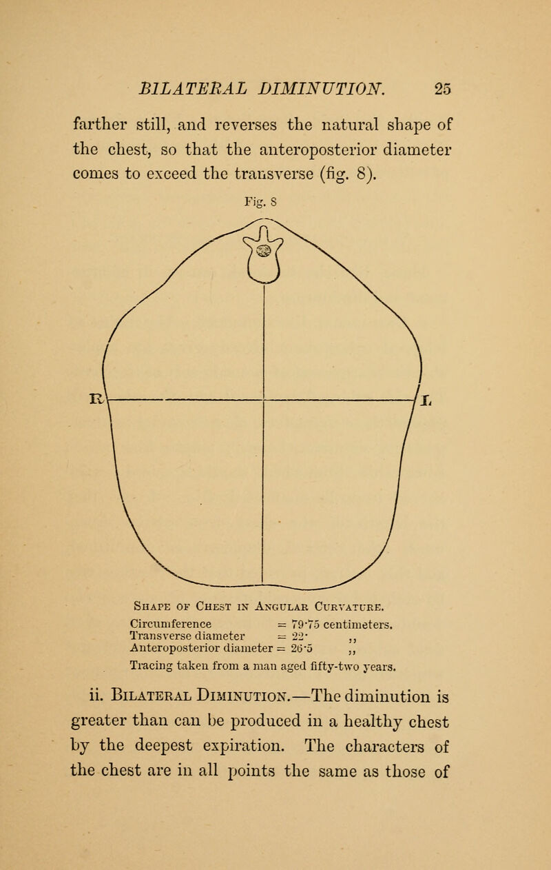 farther still, and reverses the natural shape of the chest, so that the anteroposterior diameter comes to exceed the transverse (fig. 8). FiK. S Shape of Chest in Angulak Curvature. Circumference = 79'To centimeters. Transverse diameter =22' ,, Anteroposterior diameter = 26'd ,, Tracing taken from a man aged fifty-two years. ii. Bilateral Diminution.—The diminution is greater than can be produced in a healthy chest by the deepest expiration. The characters of the chest are in all points the same as those of