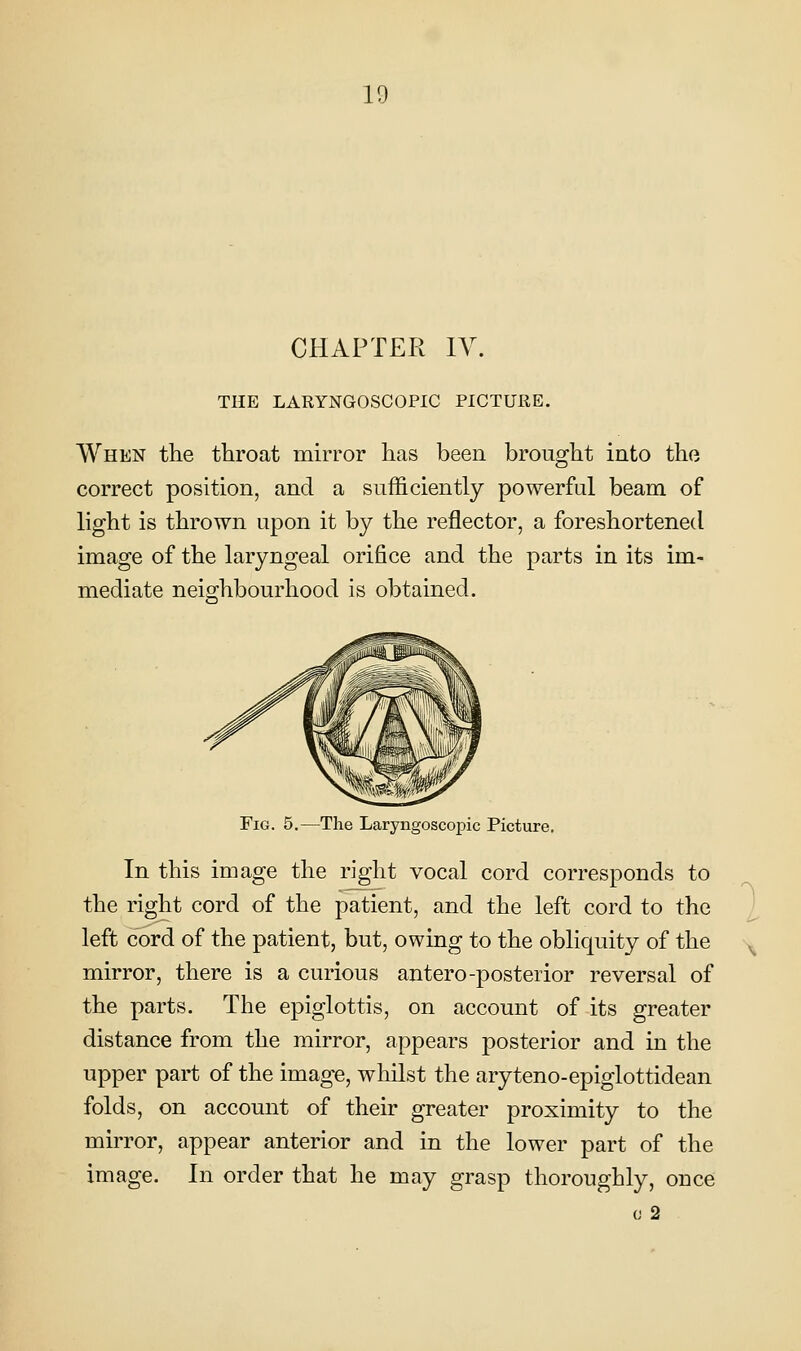 10 CHAPTER lY. THE LARYNGOSCOPIC PICTURE. When the throat mirror has been brought into the correct position, and a sufficiently powerful beam of light is thrown upon it by the reflector, a foreshortened image of the laryngeal orifice and the parts in its im- mediate neighbourhood is obtained. Fig. 5.—The Laryngoscopic Picture. In this image the right vocal cord corresponds to the right cord of the patient, and the left cord to the I left cord of the patient, but, owing to the obliquity of the ^^ mirror, there is a curious antero-posterior reversal of the parts. The epiglottis, on account of its greater distance from the mirror, appears posterior and in the upper part of the image, whilst the aryteno-epiglottidean folds, on account of their greater proximity to the mirror, appear anterior and in the lower part of the image. In order that he may grasp thoroughly, once (J 2