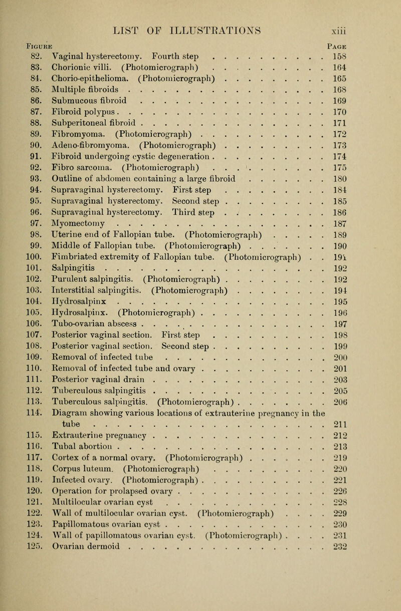 Figure Page 82. Vaginal hysterectomy. Fourth step 158 83. Chorionic villi. (Photomicrograph) 164 84. Chorio-epithelioma. (Photomicrograph) 165 85. Multiple fibroids 168 86. Submucous fibroid 169 87. Fibroid polypus 170 88. Subperitoneal fibroid 171 89. Fibromyoma. (Photomicrograph) 172 90. Adeno-fibromyoma. (Photomicrograph) 173 91. Fibroid undergoing cystic degeneration 174 92. Fibro sarcoma. (Photomicrograph) 175 93. Outline of abdomen containing a large fibroid 180 94. Supravaginal hysterectomy. First step 184 95. Supravaginal hysterectomy. Second step 185 96. Supravaginal hysterectomy. Third step 186 97. Myomectomy 187 98. Uterine end of Fallopian tube. (Photomicrograph) 1S9 99. Middle of Fallopian tube. (Photomicrograph) ....... 190 100. Fimbriated extremity of Fallopian tube. (Photomicrograph) . . 19i 101. Salpingitis 192 102. Purulent salpingitis. (Photomicrograph) 192 103. Interstitial salpingitis. (Photomicrograph) 194 104. Hydrosalpinx 195 105. Hydrosalpinx. (Photomicrograph) 196 106. Tubo-ovarian abscess 197 107. Posterior vaginal section. First step 198 108. Posterior vaginal section. Second step 199 109. Removal of infected tube 200 110. Removal of infected tube and ovary 201 111. Posterior vaginal drain 203 112. Tuberculous salpingitis 205 113. Tuberculous salpingitis. (Photomicrograph) 206 114. Diagram showing various locations of extrauterine pregnancy in the tube 211 115. Extrauterine pregnancy 212 116. Tubal abortion 213 117. Cortex of a normal ovary. (Photomicrograph) ....... 219 IIS. Corpus luteum. (Photomicrograph) 220 119. Infected ovary. (Photomicrograph) 221 120. Operation for prolapsed ovary 226 121. Multilocular ovarian cyst 228 122. Wall of multilocular ovarian cyst. (Photomicrograph) .... 229 123. Papillomatous ovarian cyst 230 124. Wall of papillomatous ovarian cyst. (Photomicrograph)- • ■ • 23] 125. Ovarian dermoid 232