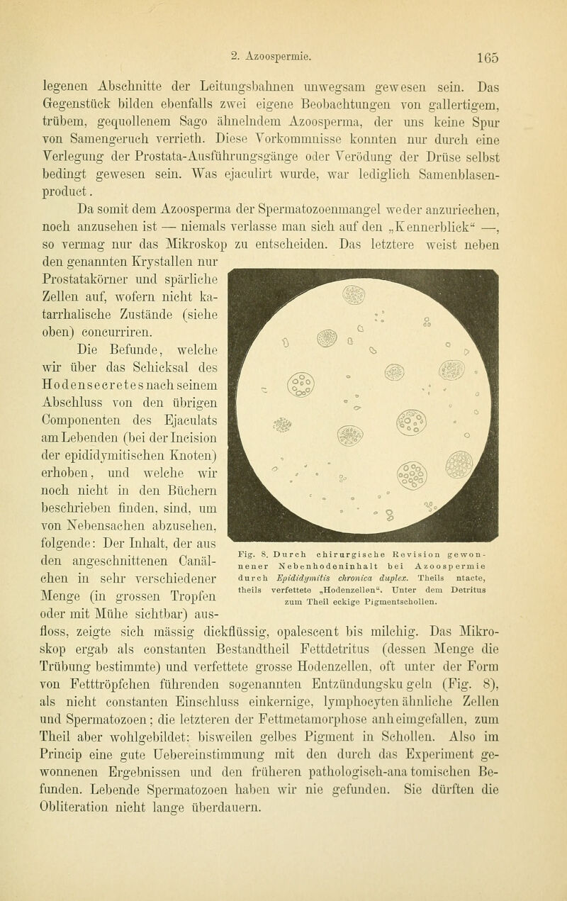 legenen Abschnitte der Leitiingsbalmen unwegsam gewesen sein. Das Gegenstück bilden ebenfalls zwei eigene Beobachtungen von gallertigem, trübem, gequollenem Sago ähnelndem Azoospernia, der uns keine Spm- von Samengeruch verrieth. Diese Vorkommnisse konnten nur durch eine Verlegung der Prostata-Ausführungsgänge oder Verödung der Drüse selbst bedingt gewesen sein. Was ejaculirt wurde, war lediglich Samenblasen- product. Da somit dem Azoosperma der Spermatozoenmangel weder anzuriechen, noch anzusehen ist — niemals verlasse man sich auf den „Kennerblick —, so vermag nur das Mikroskop zu entscheiden. Das letztere weist neben den genannten Krystallen nur Prostatakörner und spärliche Zellen auf, wofern nicht ka- tarrhalische Zustände (siehe oben) concurriren. Die Befunde, welche wir über das Schicksal des Ho densecr et es nach seinem Abschluss von den übrigen Oomponenten des Ejaculats am Lebenden (bei der Incision der epididymitisehen Knoten) erhoben, und welche wir noch nicht in den Büchern beschrieben finden, sind, um von Nebensachen abzusehen, folgende: Der Inhalt, der aus den angeschnittenen Oanäl- ehen in sehr verschiedener Menge (in grossen Tropfen oder mit Mühe sichtbar) aus- floss, zeigte sich massig dickflüssig, opalescent bis milchig. Das Mikro- skop ergab als eonstanten Bestandtheil Fettdetritus (dessen Menge die Trübung bestimmte) und verfettete grosse Hodenzellen, oft unter der Form von Fetttröpfchen führenden sogenannten Entzündungsku geln (Fig. 8), als nicht eonstanten Einschluss einkernige, lymphocyten ähnliche Zellen und Spermatozoen; die letzteren der Fettmetamorphose anheimgefallen, zum Theil aber wohlgebildet: bisweilen gelbes Pigment in Schollen. Also im Princip eine gute Uebereinstimmung mit den durch das Experiment ge- wonnenen Ergebnissen und den früheren pathologisch-anatomischen Be- funden. Lebende Spermatozoen haben wir nie gefunden. Sie dürften die Obliteration nicht lanffe überdauern. Fig. 8. Durch chirurgische Revision gewon- nener Nebenhodeninhalt bei Azoospermie durch Epididtjmitis chronica duplex. Theils ntacte, theils verfettete „Hodenzellen. Unter dem Detritus zum Theil eckige Pigmentschollen.