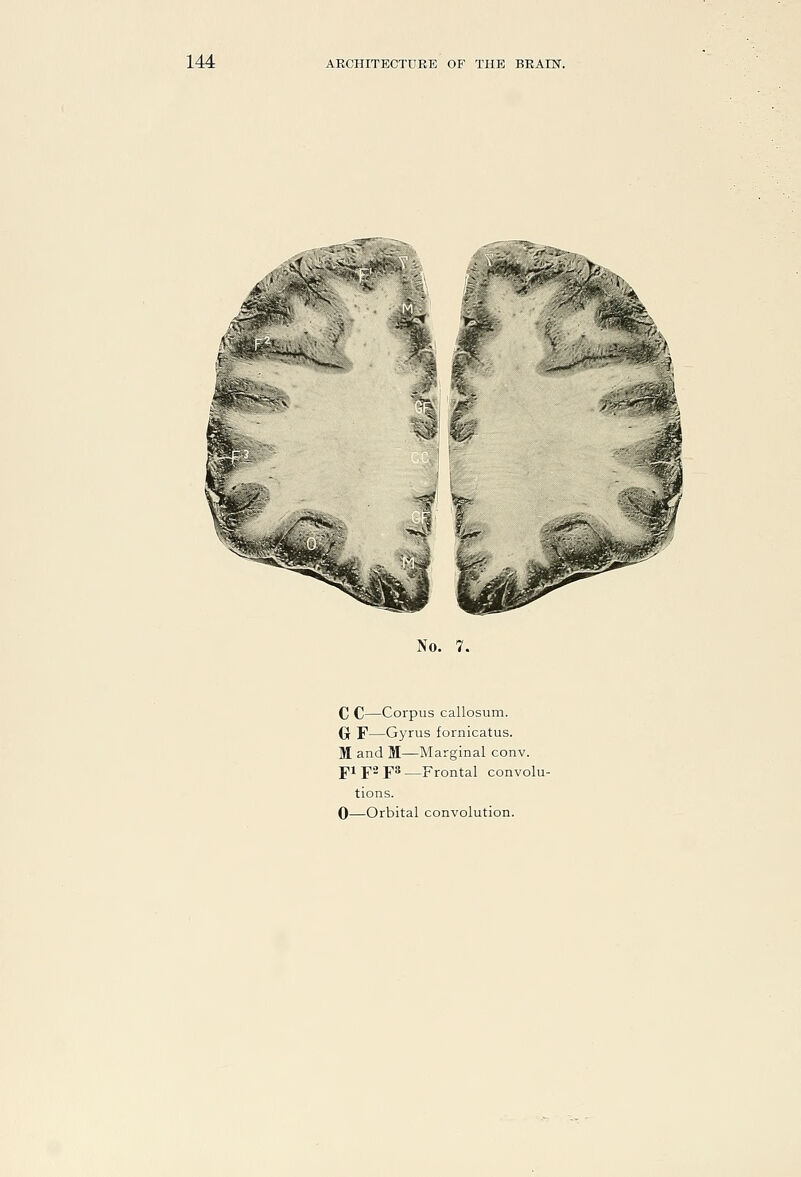 No. 7. C C—Corpus callosum. Of F—Gyrus fornicatus. M and M—Marginal conv. j'lj'aj'S—Frontal convolu- tions.