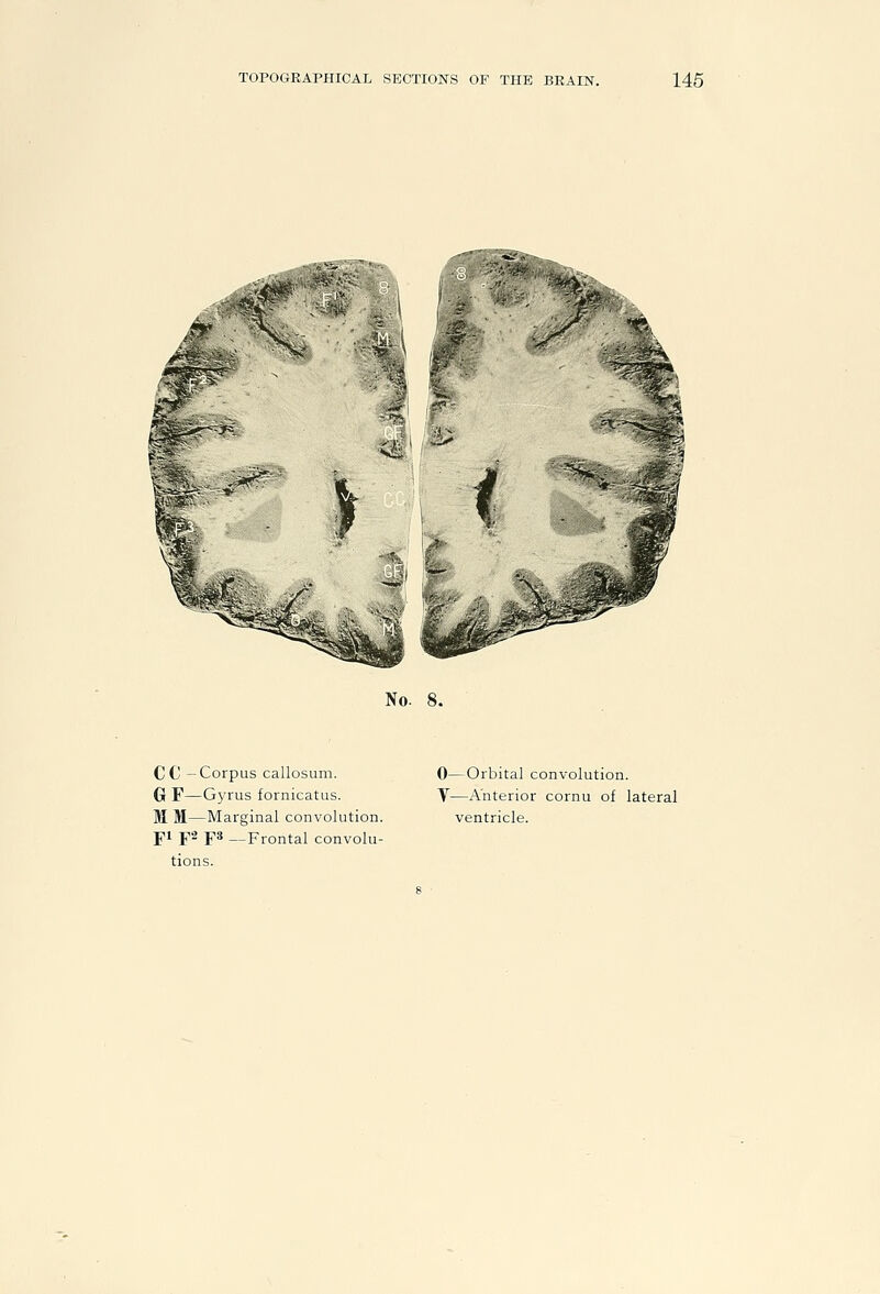 No. 8. CC -Corpus callosum. G F—Gyrus fornicatus. M M—Marginal convolution. f 1 Y^ F* —Frontal convolu- tions. 0—Orbital convolution. V—Anterior cornu of lateral ventricle.