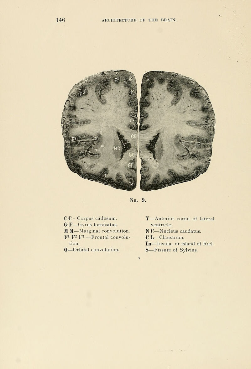 No. 9. CC^ Corpus callosiim. Gr F—Gyrus fornicatus. M M—Marginal convolution. pi p2 j,-3 —Frontal convolu- tion. 0—Orbital convolution. Y—Anterior cornu of lateral ventricle. N C—Nucleus caudatus. C L—Claustrum. In—Insula, or island of Riel. S'—Fissure of Sylvius.