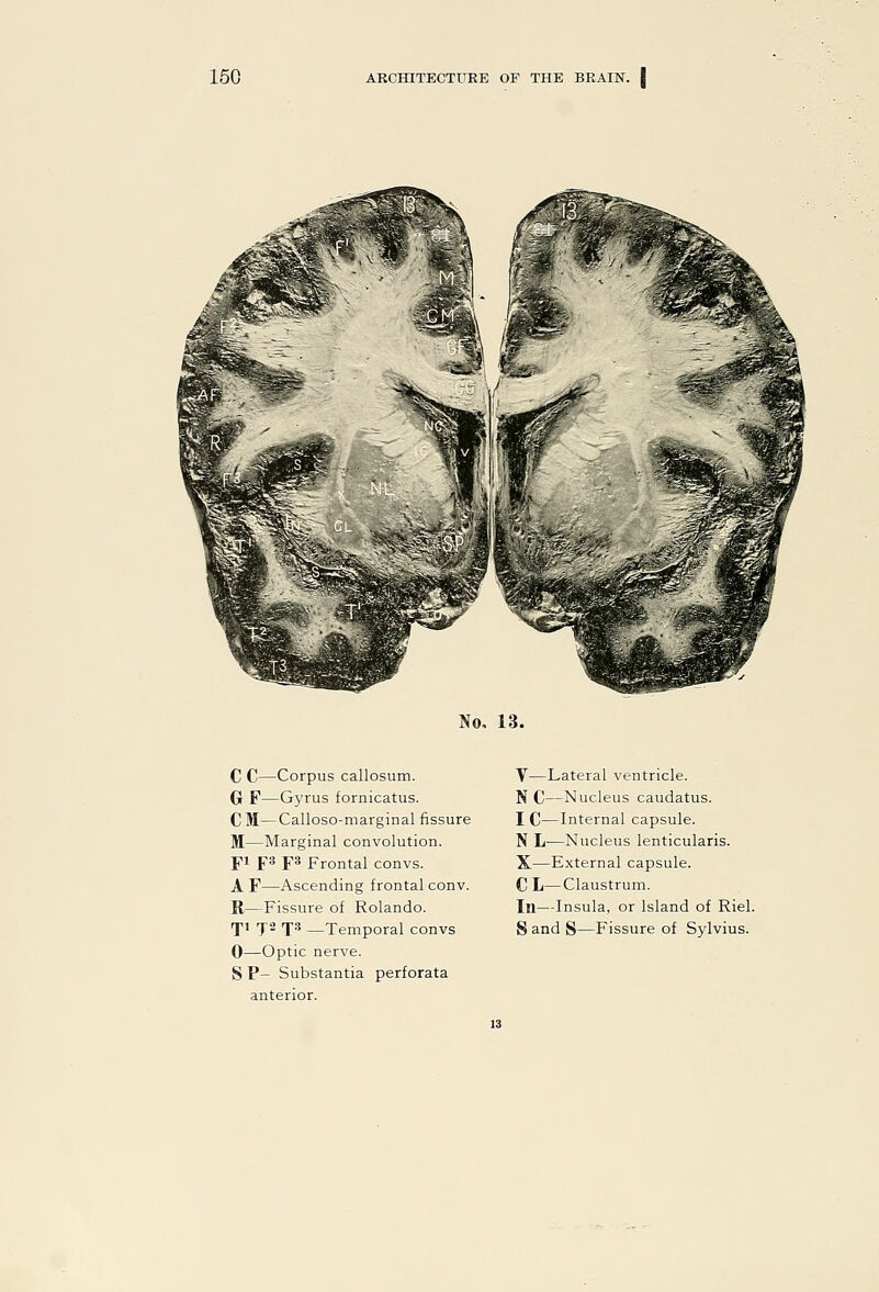 No, 13. C C—Corpus callosum. G F—Gyrus fornicatus. CM—Calloso-marginal fissure M—Marginal convolution. pi f 3 ps Frontal convs. A F—Ascending frontal conv. K-—Fissure of Rolando. 0—Optic nerve. S P- Substantia perforata anterior. V—Lateral ventricle. N C—Nucleus caudatus. I C—Internal capsule. N L—Nucleus lenticularis. X—External capsule. C L—Claustrum. In—Insula, or Island of Riel.