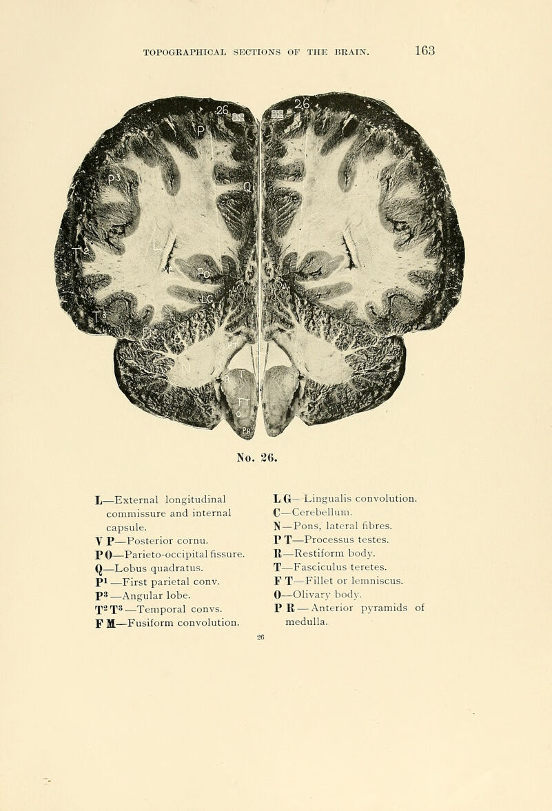 No. 26. L—External longitudinal commissure and internal capsule. y P—Posterior cornu. PO—Parieto-occipital fissure. Q—Lobus quadratus. pi —First parietal conv. ps—Angular lobe. rf2X3—Temporal convs. F M—Fusiform convolution. L G— Lingualis convolution. C—Cerebellum. N — Pons, lateral fibres. P T—Processus testes. R—Restiform body. T—Fasciculus teretes. F T—Fillet or lemniscus. 0—Olivary bod}'. PR — Anterior p3-ramids of medulla.