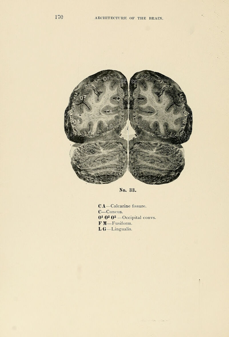 No. 33. C A—Calcarine fissure. C—Cuneus. 0* 0^ 0^ —Occipital convs. F M—Fusiform.