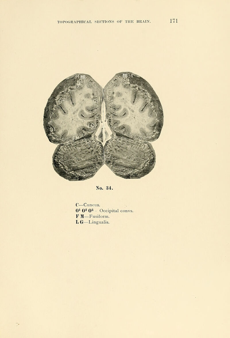 No. 34. C—Cuneus. 0^ 0^ 0^ - Occipital convs. F M—Fusiform.