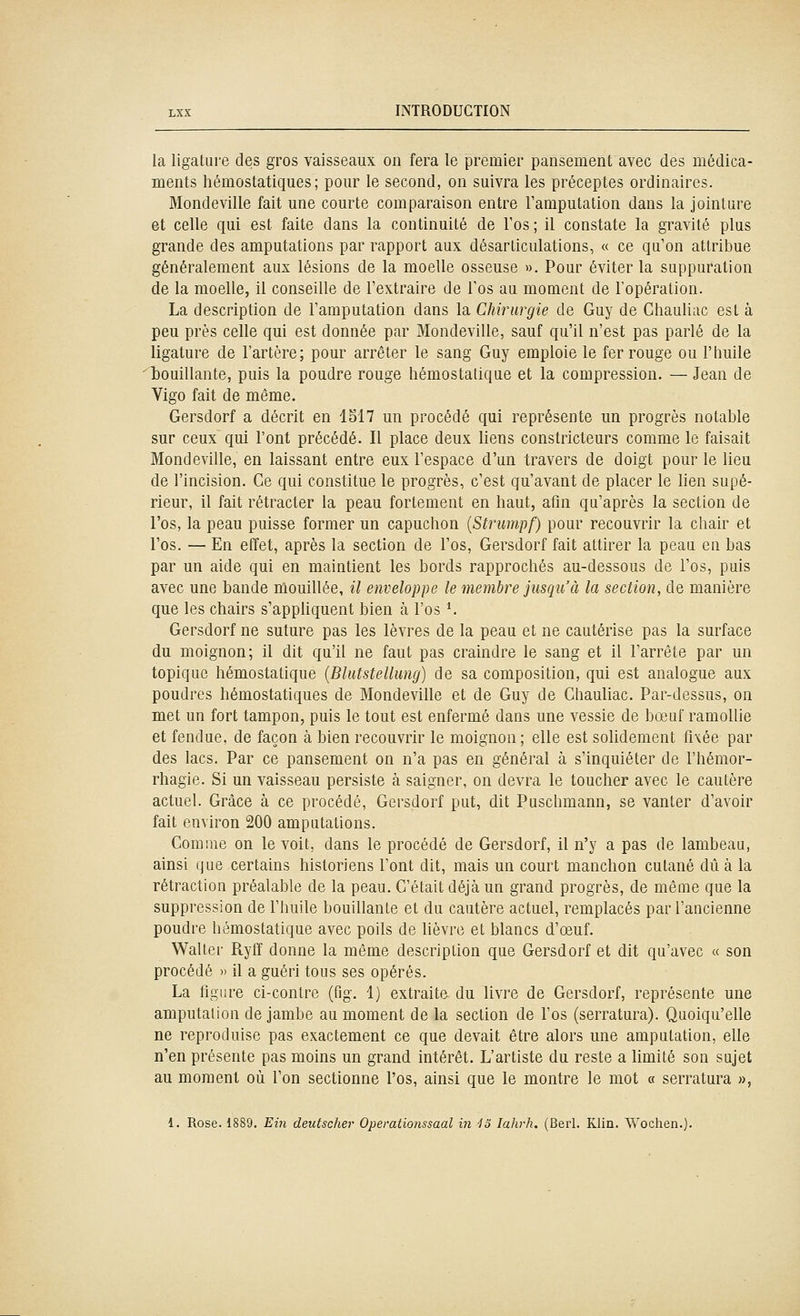 la ligature des gros vaisseaux on fera le premier pansement avec des médica- ments hémostatiques; pour le second, on suivra les préceptes ordinaires. Mondeville fait une courte comparaison entre Famputation dans la jointure et celle qui est faite dans la continuité de l'os ; il constate la gravité plus grande des amputations par rapport aux désarticulations, « ce qu'on attribue généralement aux lésions de la moelle osseuse ». Pour éviter la suppuration de la moelle, il conseille de l'extraire de l'os au moment de l'opération. La description de l'amputation dans la Chirurgie de Guy de Chauliac est à peu près celle qui est donnée par Mondeville, sauf qu'il n'est pas parlé de la ligature de l'artère; pour arrêter le sang Guy emploie le fer rouge ou l'huile lyouillante, puis la poudre rouge hémostatique et la compression. — Jean de Vigo fait de même. Gersdorf a décrit en 1517 un procédé qui représente un progrès notable sur ceux qui l'ont précédé. Il place deux liens constricteurs comme le faisait Mondeville, en laissant entre eux l'espace d'un travers de doigt pour le lieu de l'incision. Ce qui constitue le progrès, c'est qu'avant de placer le lien supé- rieur, il fait rétracter la peau fortement en haut, afln qu'après la section de l'os, la peau puisse former un capuchon {Strumpf) pour recouvrir la chair et l'os. — En effet, après la section de l'os, Gersdorf fait attirer la peau en bas par un aide qui en maintient les bords rapprochés au-dessous de l'os, puis avec une bande mouillée, il enveloppe le membre jusqu'à la section, de manière que les chairs s'appliquent bien à l'os *. Gersdorf ne suture pas les lèvres de la peau et ne cautérise pas la surface du moignon; il dit qu'il ne faut pas craindre le sang et il l'arrête par un topique hémostatique {Blutstellung) de sa composition, qui est analogue aux poudres hémostatiques de Mondeville et de Guy de Chauliac. Par-dessus, on met un fort tampon, puis le tout est enfermé dans une vessie de bœuf ramollie et fendue, de façon à bien recouvrir le moignon; elle est solidement fixée par des lacs. Par ce pansement on n'a pas en général à s'inquiéter de l'hémor- rhagie. Si un vaisseau persiste à saigner, on devra le toucher avec le cautère actuel. Grâce à ce procédé, Gersdorf put, dit Puschmann, se vanter d'avoir fait environ 200 amputations. Comme on le voit, dans le procédé de Gersdorf, il n'y a pas de lambeau, ainsi que certains historiens l'ont dit, mais un court manchon cutané dû à la rétraction préalable de la peau. C'était déjà un grand progrès, de même que la suppression de l'huile bouillante et du cautère actuel, remplacés par l'ancienne poudre hémostatique avec poils de hèvre et blancs d'œuf. Waller Ryff donne la même description que Gersdorf et dit qu'avec « son procédé » il a guéri tous ses opérés. La figure ci-conlre (fig. 1) extraite du livre de Gersdorf, représente une amputation de jambe au moment de la section de l'os (serratura). Quoiqu'elle ne reproduise pas exactement ce que devait être alors une amputation, elle n'en présente pas moins un grand intérêt. L'artiste du reste a limité son sujet au moment où l'on sectionne l'os, ainsi que le montre le mot « serratura », 1. Rose. 1889. Ein deutscher Operatiojissaal in 13 lahrh. (Berl. Klin. Wochen.).