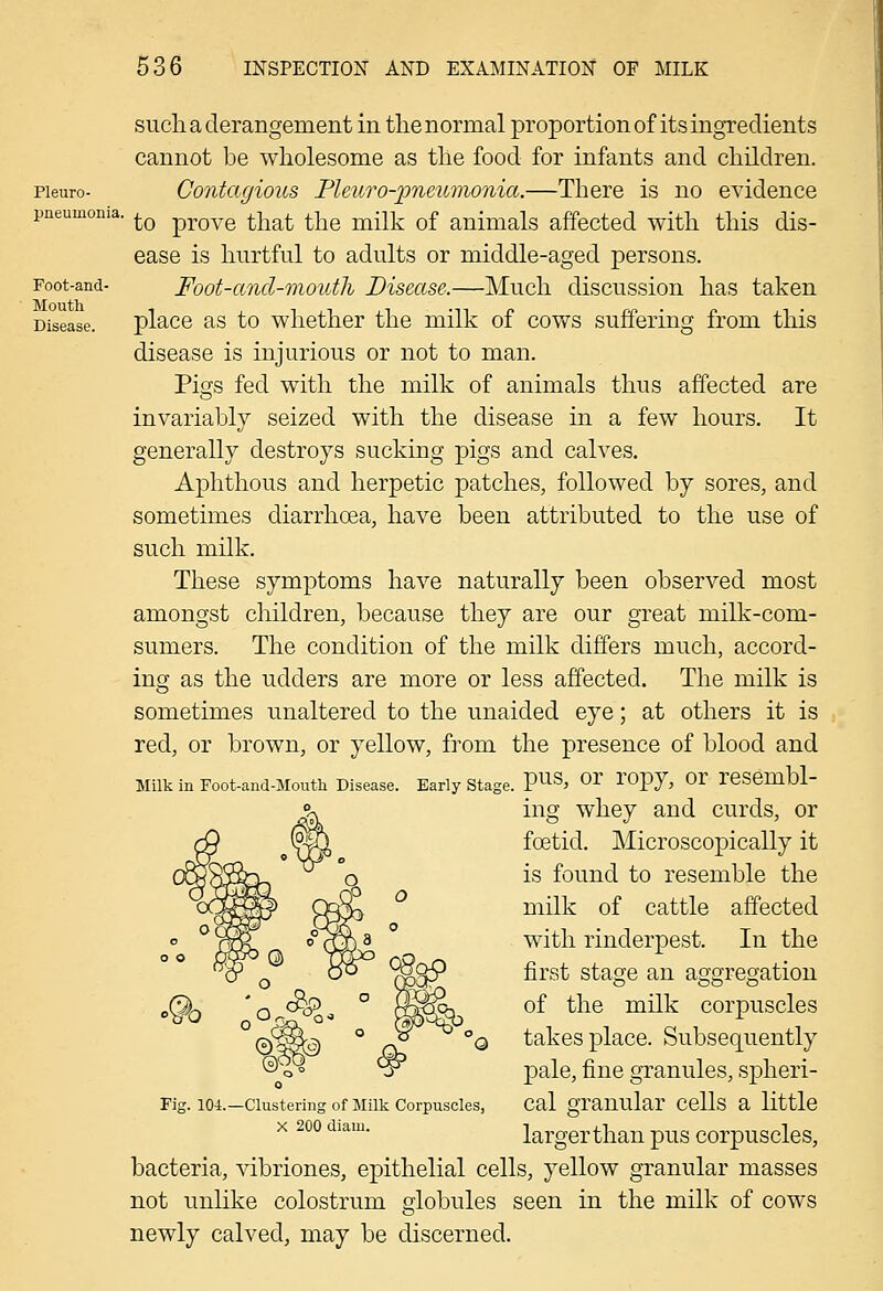Pleuro- pneumonia. Foot-and- Mouth Disease. such a derangement in the normal proportion of its ingredients cannot be wholesome as the food for infants and children. Contagious Pleuro-2oneu7nonia.—There is no evidence to prove that the milk of animals affected with this dis- ease is hurtful to adults or middle-aged persons. Foot-and-mouth Disease.—Much discussion has taken place as to whether the milk of cows suffering from this disease is injurious or not to man. Pigs fed with the milk of animals thus affected are invariably seized with the disease in a few hours. It generally destroys sucking pigs and calves. Aphthous and herpetic patches, followed by sores, and sometimes diarrhoea, have been attributed to the use of such milk. These symptoms have naturally been observed most amongst children, because they are our great milk-com- sumers. The condition of the milk differs much, accord- ing as the udders are more or less affected. The milk is sometimes unaltered to the unaided eye; at others it is red, or brown, or yellow, from the presence of blood and Milk in Foot-and-Mouth Disease. Early Stage. P^^' ^^ ^'Opy, Or resembl- ing whey and curds, or foetid. Microscopically it is found to resemble the milk of cattle affected with rinderpest. In the first stage an aggregation of the milk corpuscles takes place. Subsequently pale, fine granules, spheri- cal granular cells a little larger than pus corpuscles, bacteria, vibriones, epithelial cells, yellow granular masses not unlike colostrum globules seen in the milk of cows newly calved, may be discerned. Fig. 104.—Clustering of Milk Corpuscles, X 200 diam.