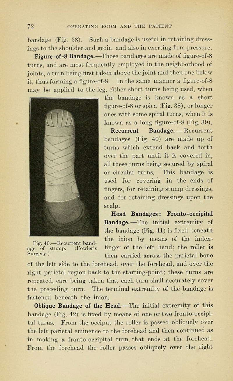 bandage (Fig. 38). Such a bandage is useful in retaining dress- ings to the shoulder and groin, and also in exerting firm pressure. Figure-of-8 Bandage.—^Those bandages are made of figure-of-8 turns, and are most frequently employed in the neighborhood of joints, a turn being first taken above the joint and then one below it, thus forming a figure-of-8. In the same manner a figure-of-8 may be applied to the leg, either short turns being used, when the bandage is known as a short figure-of-8 or spica (Fig. 38), or longer ones with some spiral turns, when it is known as a long figure-of-8 (Fig. 39). Recurrent Bandage.—Recurrent bandages (Fig. 40) are made up of turns which extend back and forth over the part until it is covered in, all these turns being secured by spiral or circular turns. This bandage is used for covering in the ends of fingers, for retaining stump dressings, and for retaining dressings upon the scalp. Head Bandages: Fronto-occipital Bandage.—^The initial extremity of the bandage (Fig. 41) is fixed beneath the inion by means of the index- finger of the left hand; the roller is then carried across the parietal bone of the left side to the forehead, over the forehead, and over the right parietal region back to the starting-point; these turns are repeated, care being taken that each turn shall accurately cover the preceding turn. The terminal extremity of the bandage is fastened beneath the inion. Oblique Bandage of the Head.—^The initial extremity of this bandage (Fig. 42) is fixed by means of one or two fronto-occipi- tal turns. From the occiput the roller is passed obliquely over the left parietal eminence to the-forehead and then continued as in making a fronto-occipital turn, that ends at the forehead. From the forehead the roller passes obliquely over the right Fig. 40.—Recurrent band- age of stump. (Fowler's Surgery.)