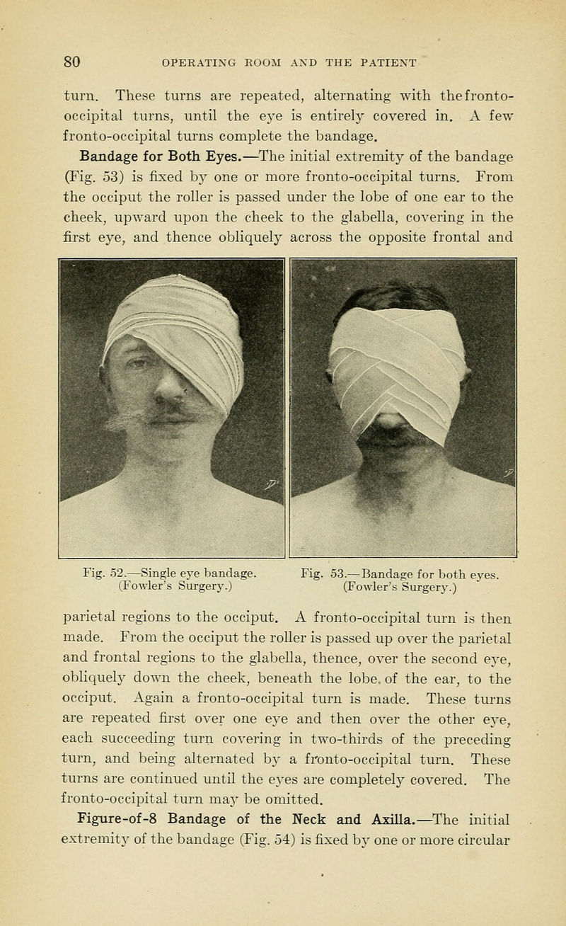 turn. These turns are repeated, alternating with the fronto- occipital turns, until the eye is entirely covered in. A few fronto-occipital turns complete the bandage. Bandage for Both Eyes.—The initial extremity of the bandage (Fig. 53) is fixed by one or more fronto-occipital turns. From the occiput the roller is passed under the lobe of one ear to the cheek, upward upon the cheek to the glabella, covering in the first eye, and thence obliquely across the opposite frontal and Fig. 52.—Single eye bandage. (Fowler's Surgery.) Fig. 53.—Bandage for both eyes. (Fowler's Surgery.) parietal regions to the occiput. A fronto-occipital turn is then made. From the occiput the roller is passed up over the parietal and frontal regions to the glabella, thence, over the second eye, obliquely down the cheek, beneath the lobe of the ear, to the occiput. Again a fronto-occipital turn is made. These turns are repeated first over one eye and then over the other eye, each succeeding turn covering in tvvo-thirds of the preceding turn, and being alternated by a fronto-occipital turn. These turns are continued until the eyes are completely covered. The fronto-occipital turn may be omitted. Figure-of-S Bandage of the Neck and Axilla.—^The initial extremity of the bandage (Fig. 54) is fixed bv one or more circular