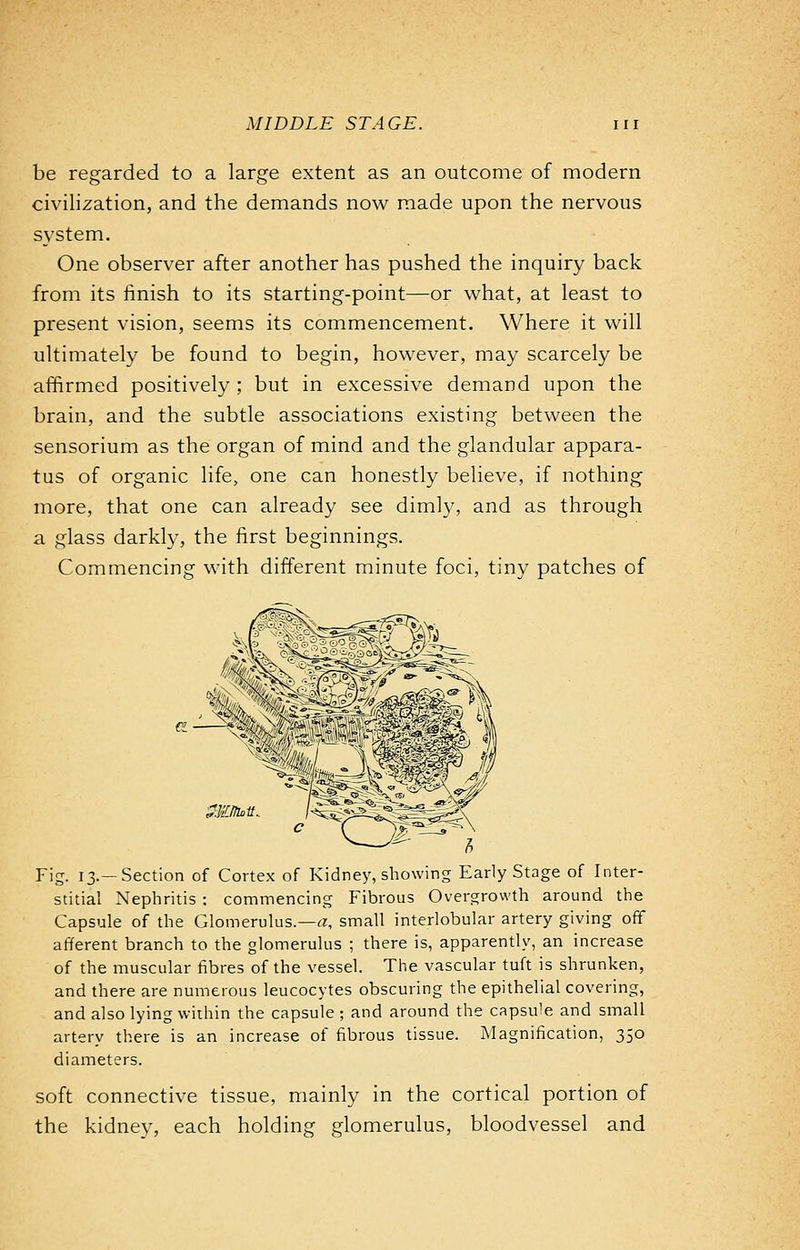 be regarded to a large extent as an outcome of modern civilization, and the demands now made upon the nervous system. One observer after another has pushed the inquiry back from its finish to its starting-point—or what, at least to present vision, seems its commencement. Where it will ultimately be found to begin, however, may scarcely be affirmed positively ; but in excessive demand upon the brain, and the subtle associations existing between the sensorium as the organ of mind and the glandular appara- tus of organic life, one can honestly believe, if nothing more, that one can already see dimly, and as through a glass darkly, the first beginnings. Commencing with different minute foci, tiny patches of SS&ff. Fig. 13.—Section of Cortex of Kidney, showing Early Stage of Inter- stitial Nephritis : commencing Fibrous Overgrowth around the Capsule of the Glomerulus.—a, small interlobular artery giving ofif afferent branch to the glomerulus ; there is, apparently, an increase of the muscular fibres of the vessel. The vascular tuft is shrunken, and there are numerous leucocytes obscuring the epithelial covering, and also lying within the capsule ; and around the capsule and small artery there is an increase of fibrous tissue. Magnification, 350 diameters. soft connective tissue, mainly in the cortical portion of the kidney, each holding glomerulus, bloodvessel and