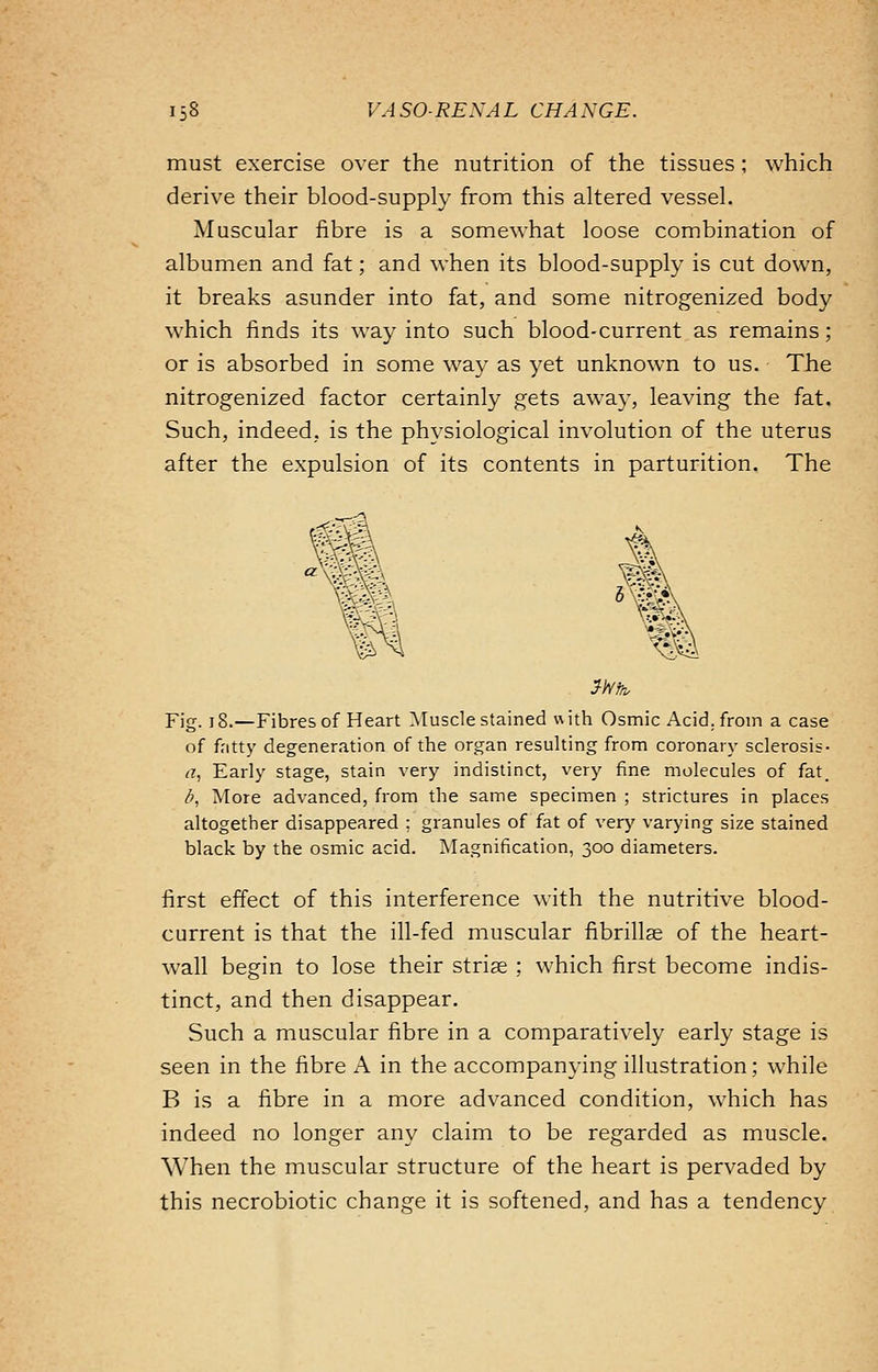 must exercise over the nutrition of the tissues; which derive their blood-supply from this altered vessel. Muscular fibre is a somewhat loose combination of albumen and fat; and when its blood-supply is cut down, it breaks asunder into fat, and some nitrogenized body which finds its way into such blood-current as remains; or is absorbed in some way as yet unknown to us. The nitrogenized factor certainly gets away, leaving the fat. Such, indeed, is the physiological involution of the uterus after the expulsion of its contents in parturition. The <®3 Fig. 18.—Fibres of Heart Muscle stained with Osmic Acid, from a case of fatty degeneration of the organ resulting from coronary sclerosis- a, Early stage, stain very indistinct, very fine molecules of fat. b, More advanced, from the same specimen ; strictures in places altogether disappeared ; granules of fat of very varying size stained black by the osmic acid. Magnification, 300 diameters. first effect of this interference with the nutritive blood- current is that the ill-fed muscular fibrillar of the heart- wall begin to lose their striae ; which first become indis- tinct, and then disappear. Such a muscular fibre in a comparatively early stage is seen in the fibre A in the accompanying illustration; while B is a fibre in a more advanced condition, which has indeed no longer any claim to be regarded as muscle. When the muscular structure of the heart is pervaded by this necrobiotic change it is softened, and has a tendency