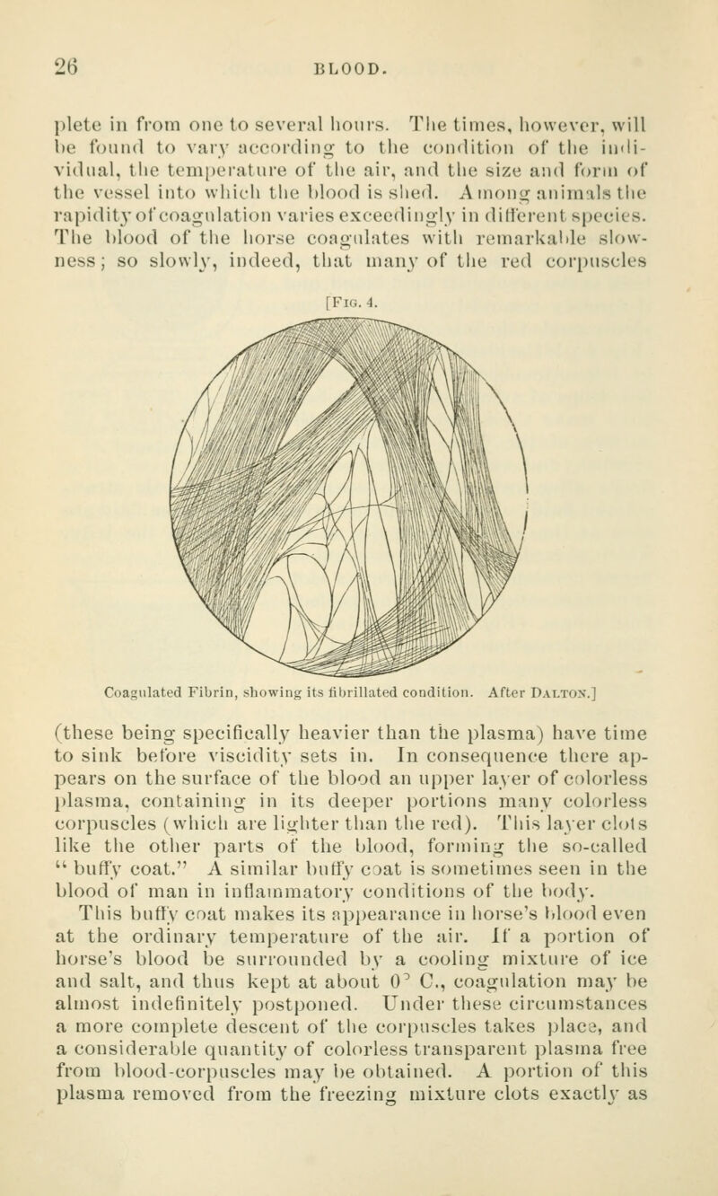 pletc in from one to several iioiii's. The times, however, will l)e found to vary according to the condition of the iiidi- vidiial, the temi)erature of the air, and the size and form of the vessel into which the blood is shed. Among animals the rapidit}'of coagulation varies exceedingly in ditlerent species. The hlood of the horse coagulates with remarkalile slow- ness ; so slowly, indeed, that many of tiie red corpuscles Coagulated Fibrin, showing its fibrillated condition. After Daltox.] (these being specifically heavier than the plasma) have time to sink before viscidity sets in. In consequence there ap- pears on the surface of the blood an upper layer of colorless l)lasma, containing in its deeper portions many colorless corpuscles (which are lighter than the red). This layer clots like the other parts of the blood, forming the so-called  buffy coat. A similar butfy coat is sometimes seen in the blood of man in inflammatory conditions of the body. This buflfy coat makes its appearance in horse's l»lood even at the ordinary temperature of the air. If a portion of horse's blood be surrounded by a cooling mixture of ice and salt, and thus kept at about 0^ C, coagulation may be almost indefinitely postponed. Under these circumstances a more complete descent of the corpuscles takes plac3, and a considerable quantity of colorless transparent plasma free from blood-corpuscles may be obtained. A portion of this plasma removed from the freezing mixture clots exacth' as