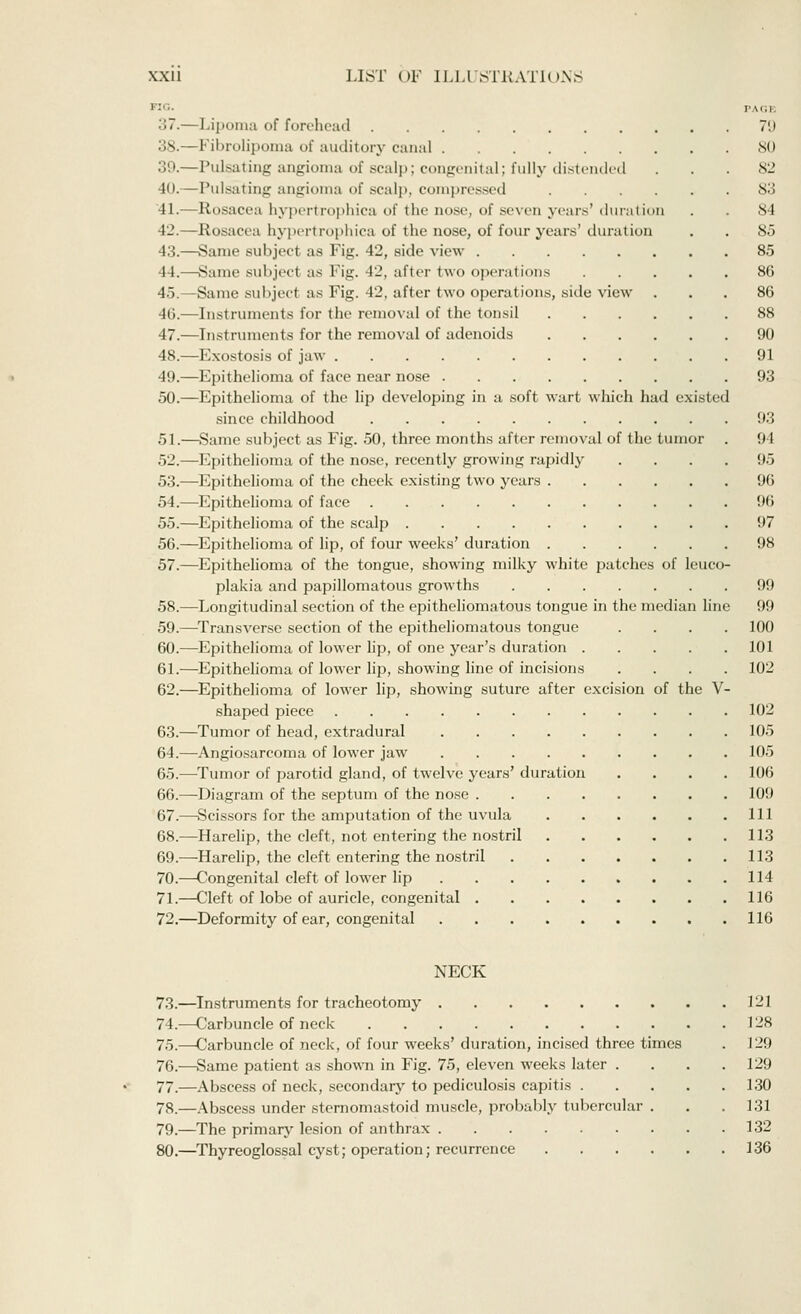 i: PAGE ;;7.—Lipoma of forehead 79 38.—Fibrolipoma of auditory canal 80 39.—Pulsating angioma of scalp; congenital; fully distended ... 82 40.—Pulsating angioma of scalp, compressed 83 '41.—Rosacea hypertrophies of the nose; <>f seven years' duration . . 84 42.—Rosacea hypertrophica of the nose, of four years'duration . . 85 43.—Same subject as Fig. 42, side view 85 44.—Same subject as Fig. 42, alter two operations 86 45.—Same subject as Fig. 42, after two operations, side view ... 86 46.—Instruments lor the removal of the tonsil 88 47.—Instruments for the removal of adenoids 90 48.—Exostosis of jaw 91 49.—Epithelioma of face near nose 93 50.—Epithelioma of the lip developing in a soft wart which had existed since childhood 93 51.—Same subject as Fig. 50, three months after removal of the tumor . !) I 52.—Epithelioma of the nose, recently growing rapidly .... 95 53.—Epithelioma of the cheek existing two years 96 54.—Epithelioma of face 96 55.—Epithelioma of the scalp 97 56.—Epithelioma of lip, of four weeks' duration 98 57.—Epithelioma of the tongue, showing milky white patches of leuco- plakia and papillomatous growths 99 58.—Longitudinal section of the epitheliomatous tongue in the median line 99 59.—Transverse section of the epitheliomatous tongue .... 100 60.—Epithelioma of lower lip, of one year's duration 101 61.—Epithelioma of lower lip, showing line of incisions .... 102 62.—Epithelioma of lower lip, showing suture after excision of the V- shaped piece 102 63.—Tumor of head, extradural 105 64.—Angiosarcoma of lower jaw 105 65.—Tumor of parotid gland, of twelve years' duration .... 106 66.—Diagram of the septum of the nose 109 67.—Scissors for the amputation of the uvula Ill 68.—Harelip, the cleft, not entering the nostril 113 69.—Harelip, the cleft entering the nostril 113 70.—Congenital cleft of lower lip 114 71.—Cleft of lobe of auricle, congenital 116 72.—Deformity of ear, congenital 116 NECK 73.—Instruments for tracheotomy 121 74.—Carbuncle of neck 128 75.—Carbuncle of neck, of four weeks' duration, incised three times . J29 76.—Same patient as shown in Fig. 75, eleven weeks later . . . .129 77.—Abscess of neck, secondary to pediculosis capitis 130 78.—Abscess under sternomastoid muscle, probably tubercular . . . 131 79.—The primary lesion of anthrax 132 80.—Thyreoglossal cyst; operation; recurrence 136