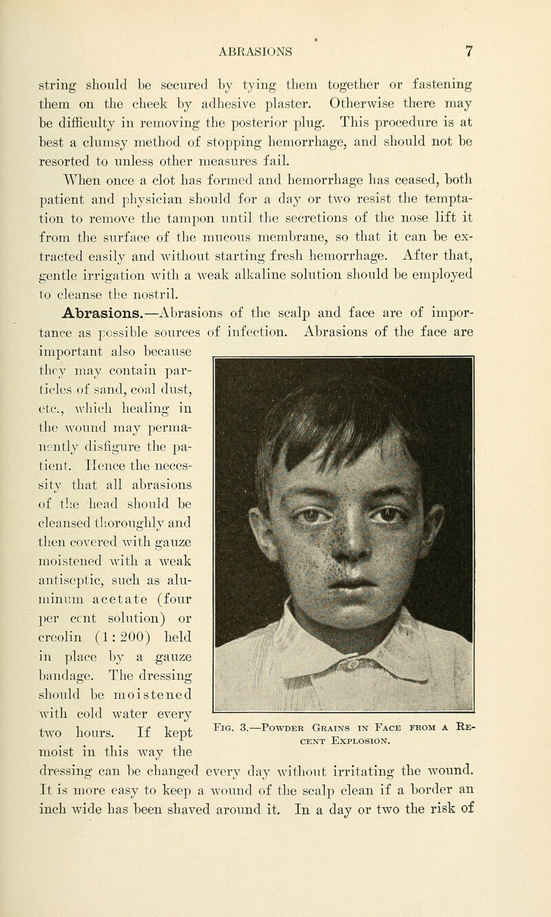 ABRASIONS string should be secured by tying them together or fastening them on the cheek by adhesive plaster. Otherwise there may be difficulty in removing the posterior plug. This procedure is at best a clumsy method of stopping hemorrhage, and should not be resorted to unless other measures fail. When once a clot has formed and hemorrhage has ceased, both patient and physician should for a day or two resist the tempta- tion to remove the tampon until the secretions of the nose lift it from the surface of the mucous membrane, so that it can be ex- tracted easily and without starting fresh hemorrhage. After that, gentle irrigation with a weak alkaline solution should be employed to cleanse the nostril. Abrasions.—Abrasions of the scalp and face are of impor- tance as possible sources of infection. Abrasions of the face are important also because they may contain par- ticles of sand, coal dust, etc., which healing in the wound may perma- nently disfigure the pa- tient. Hence the neces- sity that all abrasions of the head should be cleansed thoroughly and then covered with gauze moistened with a weak antiseptic, such as alu- minum acetate (four per cent solution) or creolin (1:200) held in place by a gauze bandage. The dressing should be moistened with cold water every two hours. If kept moist in this way the dressing can be changed every day without irritating the wound. It is more easy to keep a wound of the scalp clean if a border an inch wide has been shaved around it. In a day or two the risk of Fig. 3. -Powder Grains in Face from a Re- cent Explosion.