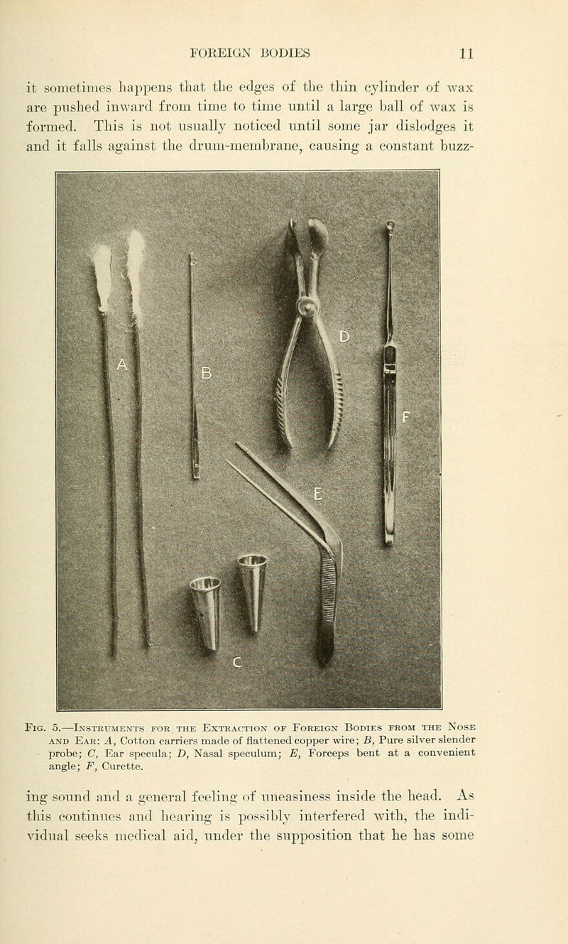 it sometimes happens that the edges of the thin cylinder of wax are pushed inward from time to time until a large ball of wax is formed. This is not usually noticed until some jar dislodges it and it falls against the drum-membrane, causing a constant buzz- Fig. 5.—Instruments for the Extraction of Foreign Bodies from the Nose and Ear: A, Cotton carriers made of flattened copper wire; B, Pure silver slender ■ probe; C, Ear specula; D, Nasal speculum; E, Forceps bent at a convenient angle; F, Curette. ing sound and a general feeling of uneasiness inside the head. As this continues and hearing is possibly interfered with, the indi- vidual seeks medical aid, under the supposition that he has some