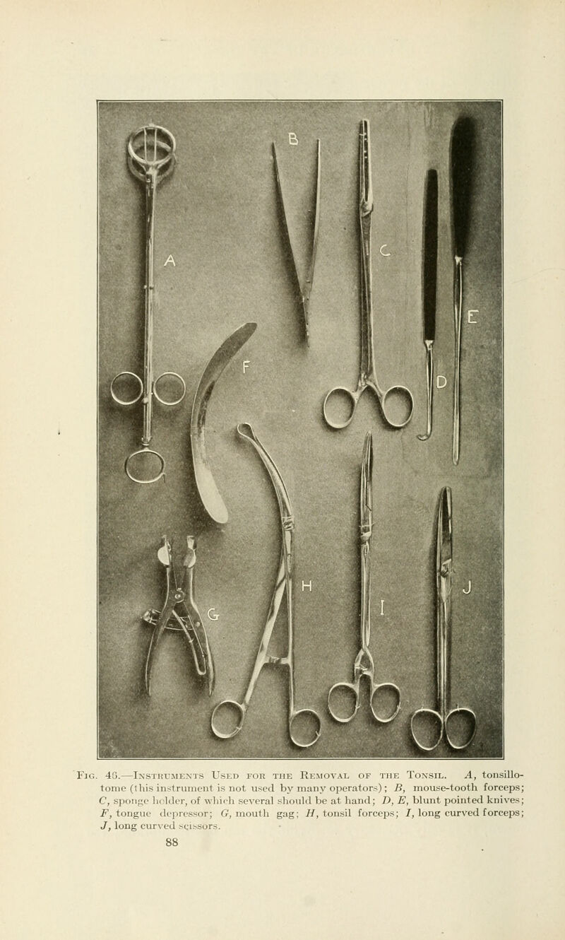 Fig. 40.—Instruments Used rem the Removal of the Tonsil. A, tonsillo- tome (this instrument is not used by many operators); B, mouse-tooth forceps; C, sponge holder, of winch several should be at hand; D, E, blunt pointed knives; F, tongue depressor; G, mouth gag; H, tonsil forceps; 7, long curved forceps; J, long curved scissors.