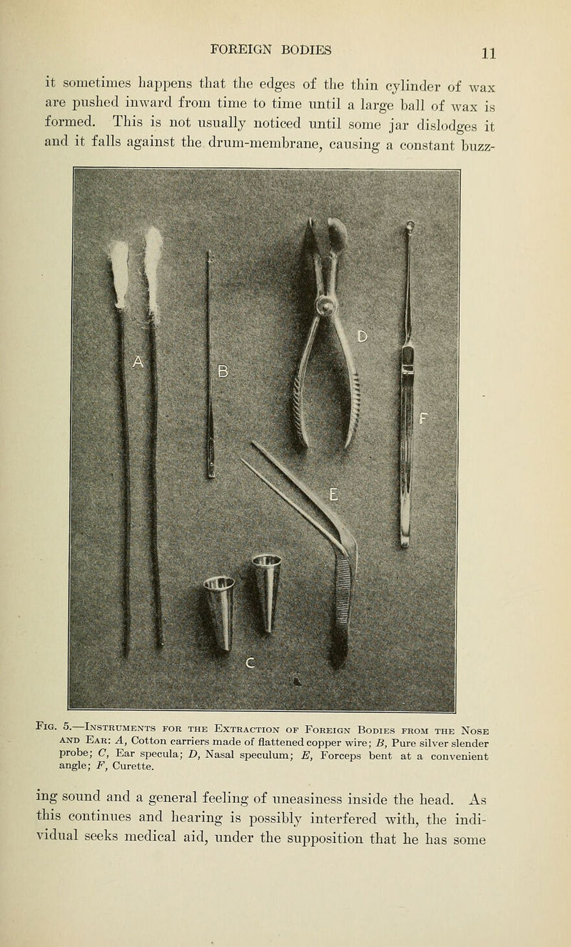 it sometimes happens that the edges of the thin cylinder of wax are pushed inward from time to time until a large ball of wax is formed. This is not usually noticed until some jar dislodges it and it falls against the drum-membrane, causing a constant buzz- FiG. 5.—Instruments for the Extraction of Foreign Bodies from the Nose AND Ear: A, Cotton carriers made of flattened copper wire; B, Pure silver slender probe; C, Ear specula; D, Nasal speculum; E, Forceps bent at a convenient angle; F, Curette. ing sound and a general feeling of uneasiness inside the head. As this continues and hearing is possibly interfered with, the indi- vidual seeks medical aid, under the supposition that he has some